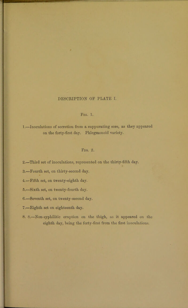 Fig. 1. 1. —Inoculations of secretion from a suppurating sore, as they appeared on the forty-first day. Phlegmonoid variety. Fig. 2. 2. —Third set of inoculations, represented on the thirty-fifth day. 3. —Fourth set, on thirty-second day. 4. —Fifth set, on twenty-eighth day. 5. —Sixth set, on twenty-fourth day. 6. —Seventh set, on twenty-second day. 7. —Eighth set on eighteenth day. 8. 8.—Non-syphilitic eruption on the thigh, as it appeared on the eighth day, being the forty-first from the first inoculations.