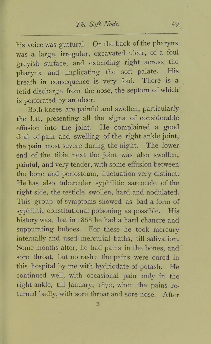 his voice was guttural. On the back of the pharynx was a large, irregular, excavated ulcer, of a foul greyish surface, and extending right across the pharynx and implicating the soft palate. His breath in consequence is very foul. There is a fetid discharge from the nose, the septum of which is perforated by an ulcer. Both knees are painful and swollen, particularly the left, presenting all the signs of considerable effusion into the joint. He complained a good deal of pain and swelling of the right ankle joint, the pain most severe during the night. The lower end of the tibia next the joint was also swollen, painful, and very tender, with some effusion between the bone and periosteum, fluctuation very distinct. He has also tubercular syphilitic sarcocele of the right side, the testicle swollen, hard and nodulated. This group of symptoms showed as bad a form of syphilitic constitutional poisoning as possible. His history was, that in 1868 he had a hard chancre and suppurating buboes. For these he took mercury internally and used mercurial baths, till salivation. Some months after, he had pains in the bones, and sore throat, but no rash; the pains were cured in this hospital by me with hydriodate of potash. He continued well, with occasional pain only in the right ankle, till January, 1870, when the pains re- turned badly, with sore throat and sore nose. After E