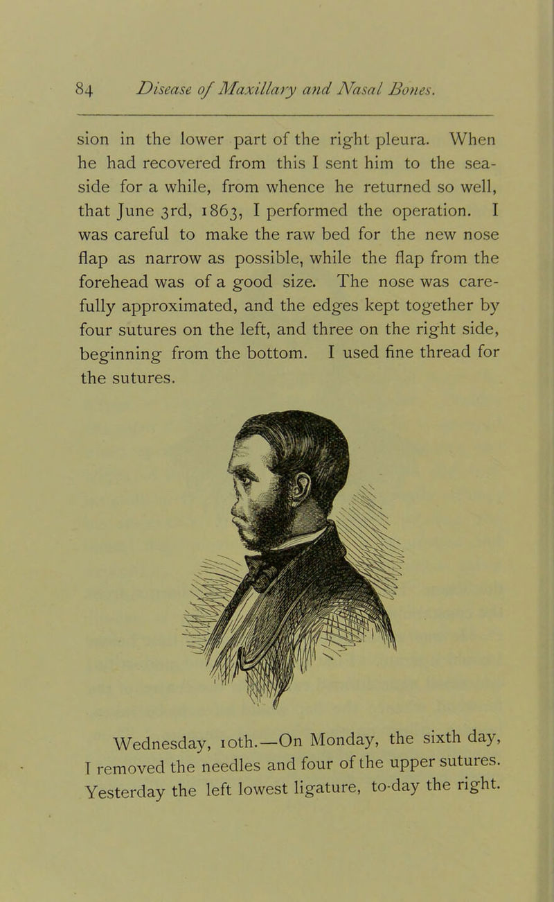 sion in the lower part of the right pleura. When he had recovered from this I sent him to the sea- side for a while, from whence he returned so well, that June 3rd, 1863, I performed the operation. I was careful to make the raw bed for the new nose flap as narrow as possible, while the flap from the forehead was of a good size. The nose was care- fully approximated, and the edges kept together by four sutures on the left, and three on the right side, beginning from the bottom. I used fine thread for the sutures. Wednesday, loth.—On Monday, the sixth day, T removed the needles and four of the upper sutures. Yesterday the left lowest ligature, to-day the right.
