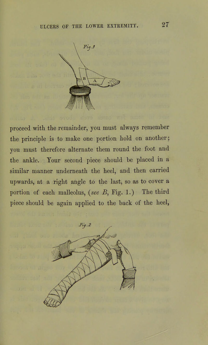 proceed with the remainder, you must always remember the principle is to make one portion hold on another; you must therefore alternate them round the foot and the ankle. Your second piece should be placed in a similar manner underneath the heel, and then carried upwards, at a right angle to the last, so as to cover a portion of each malleolus, {see Fig. 1.) The third piece should be again applied to the back of the heel,