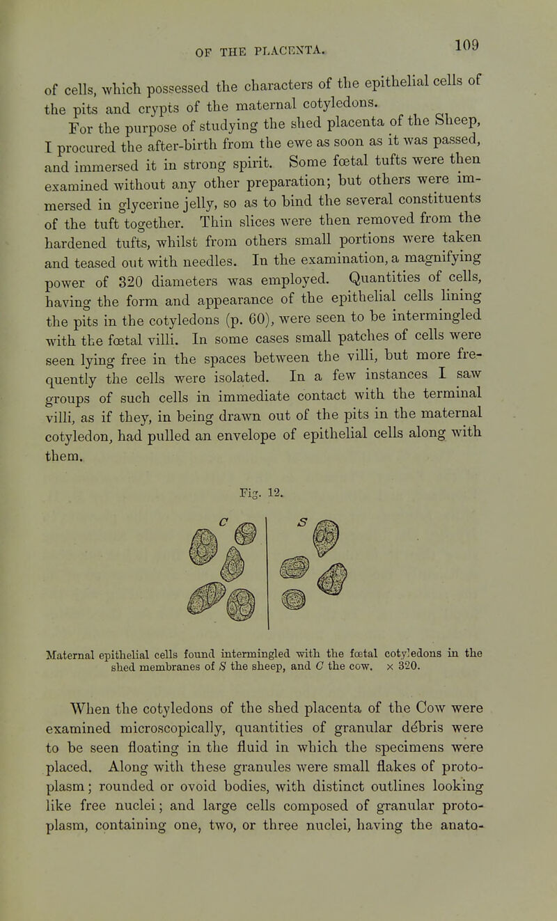 of cells, whicli possessed the characters of the epithelial cells of the pits and crypts of the maternal cotyledons. For the purpose of studying the shed placenta of the Sheep, I procured the after-birth from the ewe as soon as it was passed, and immersed it in strong spirit. Some foetal tufts were then examined without any other preparation; but others were im- mersed in glycerine jelly, so as to bind the several constituents of the tuft together. Thin slices were then removed from the hardened tufts, whilst from others small portions were taken and teased out with needles. In the examination, a magnifying power of 320 diameters was employed. Quantities of cells, having the form and appearance of the epithehal cells lining the pUs in the cotyledons (p. 60), were seen to be intermingled with the foetal villi. In some cases small patches of cells were seen lying free in the spaces between the villi, but more fre- quently the cells were isolated. In a few instances I saw groups of such cells in immediate contact with the terminal villi, as if they, in being drawn out of the pits in the maternal cotyledon, had pulled an envelope of epithelial cells along with them. Fig. 12. Maternal epithelial cells found intermingled -with the foetal cotyledons in the shed membranes of S the sheep, and C the cow. x 320. When the cotyledons of the shed placenta of the Cow were examined microscopically, quantities of granular debris were to be seen floating in the fluid in which the specimens were placed. Along with these granules were small flakes of proto- plasm ; rounded or ovoid bodies, with distinct outlines looking like free nuclei; and large cells composed of granular proto- plasm, containing one, two, or three nuclei, having the anato-