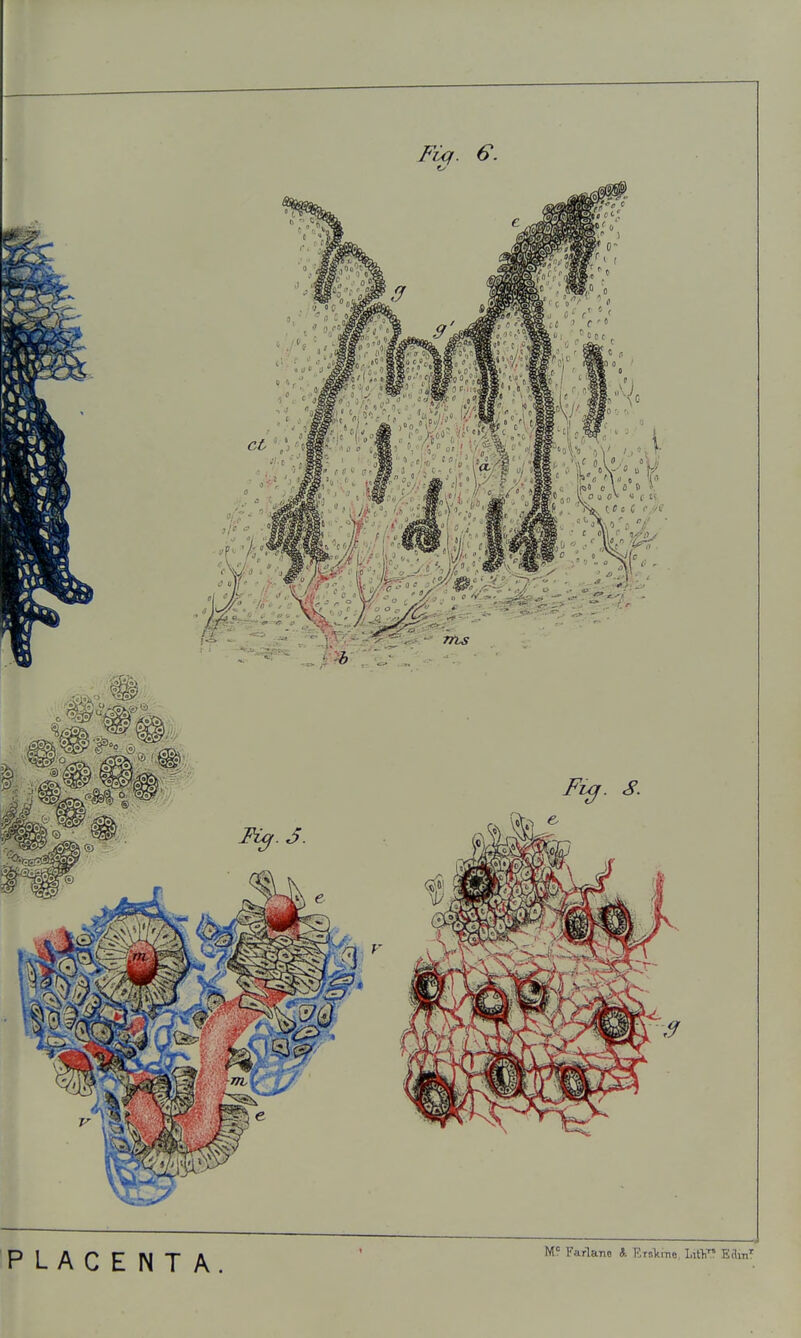 1/ PLACENTA M? Farlans & Eisltmo. LiW Earn'