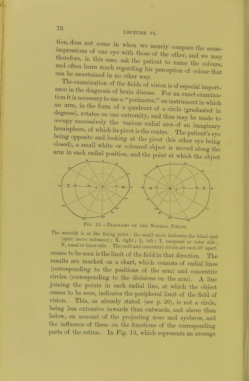 LECTUKE VI, can be ascertained in no other way n..?' TT'-°f especial import- tioniii ' ^''T '^'^ - exactexaW- an aim m the form of a quadrant of a cii-cle (graduated in degrees), rotates on one extremity, and thus may be m de o occupy successively the various radial arcs of L imagin j; hemisphere, of which its pivot is the centre. The patienis eye being opposite and looHng at the pivot (his other eye being closed), a small white or colom^ed object is moved along the arm m each radial position, and the point at wliich the obiect 30 o J Fig. 13. —Diagkam.s of the Koemal Fields. The asterisk is at the fixing point; the small circle indicates the blind spot (optic nerve enti-ance) ; R, right ; L, left; T, temporal or outer side ; N, nasal or inner side. The radii and concentric circles are each -30° apart. ceases to be seen is the Hmit of the field in that dii-ection. The results al-e marked on a chart, which consists of radial Hues (corresponding to the positions of the arm) and concentric circles (corresponding to the divisions on the arm). A line joining the points in each radial line, at which the object ceases to be seen, indicates the peripheral limit of the field of vision. This, as abeady stated (see p. 20), is not a cii-cle, being less extensive inwards than outwards, and above than below, on account of the projecting nose and eyebrow, and the influence of these on the fimctions of the con-esponding parts of the retina. In Fig. 13, which represents an average