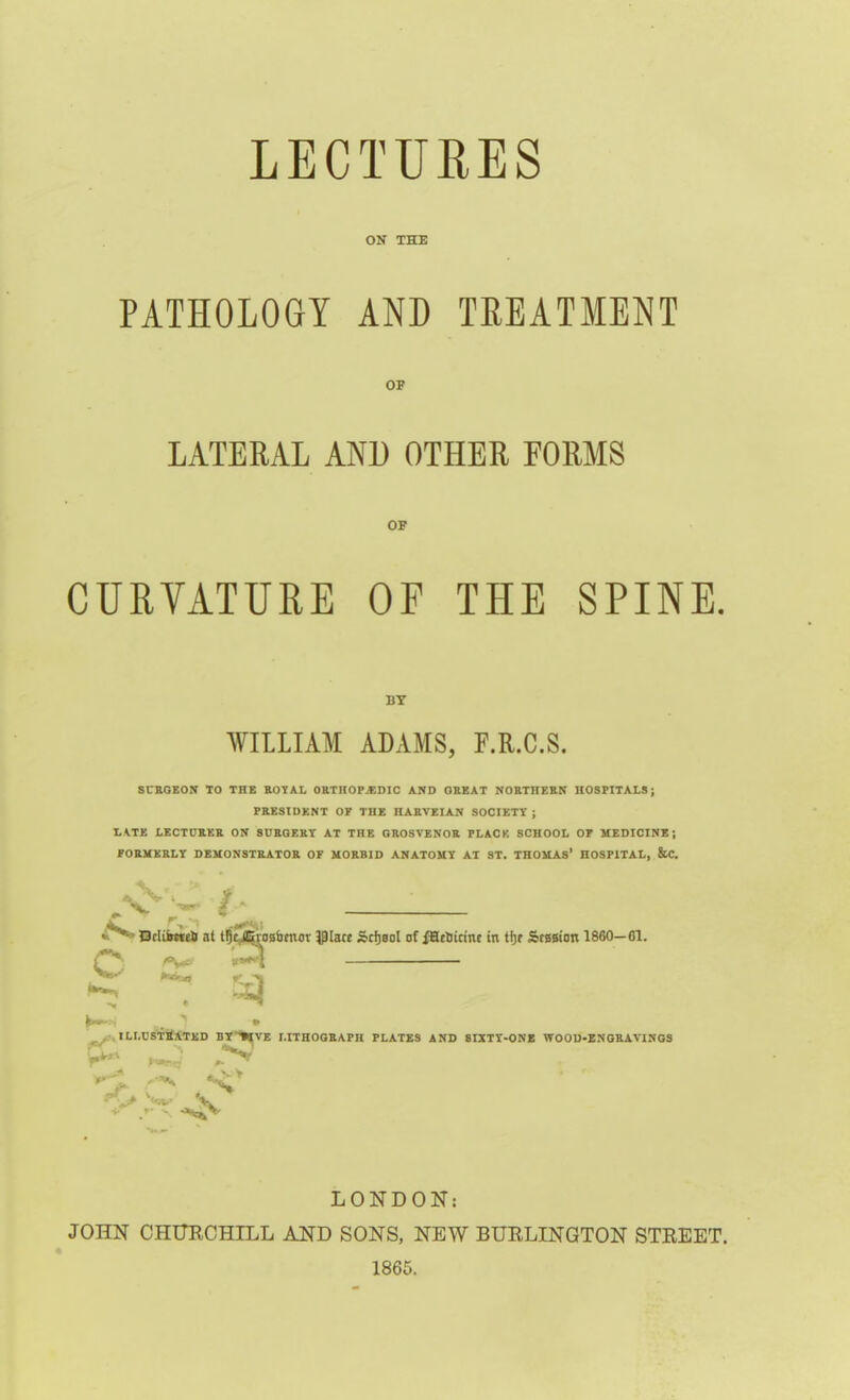 LECTURES ON THE PATHOLOGY AND TEEATMENT OP LATERAL AND OTHER FORMS 07 CURVATURE OP THE SPINE, BT WILLIAM ADAMS, F.R.C.S. SUEGEON TO THE ROTAL OKTKOP.BDIC AND OEEAT NOETHERN HOSPITALS; PRESIDENT OK THE HAEVEIAN SOCIETY; ■LKTK LECTDRKR ON SURGERY AT THE OROSVENOR PLACK SCHOOL OP MEDICINE; FORUKaLY DEKONSTRATOE OF MORBID ANATOMY AT ST. THOMAS' HOSPITAL, &C. f^DcIiiwtrfi at tDc^osbmor ^hct Sri)Bol of fartirinc in tfjr Sfggioit 1860-61. ^ ^UiILLCSTtfATED By^VE MTHOGRAPH PLATES AND SIXTY-ONE WOOU-ZNGRAVINOS \^ ^ ^> LONDON: JOHN CHTTECHILL AND SONS, NEW BUELINGTON STREET. 1865.