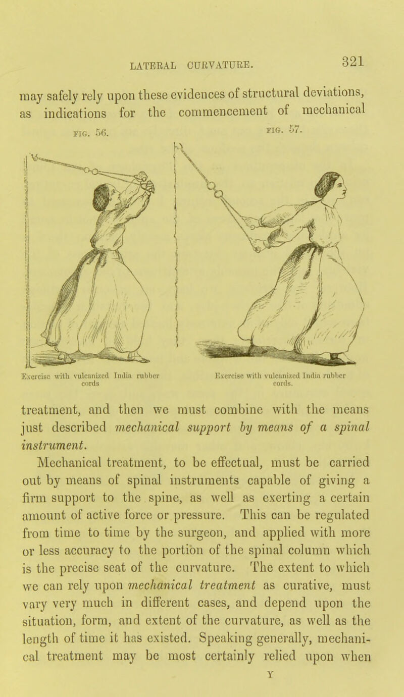 may safely rely upon these evidences of structural deviations, as indications for the commencement of mechanical riG. 56. FIG. 57. Exercise with \Tilcani7.cd India rubber cords Exercise with vulcunized India nibbcr cords. treatment, and then v?e must combine witli the means just described mechanical support by means of a spinal instrument. Mechanical treatment, to be effectual, must be carried out by means of spinal instruments capable of giving a firm support to the spine, as well as exerting a certain amount of active force or pressure. This can be regulated from time to time by the surgeon, and apphed with more or less accuracy to the portion of the spinal column which is the precise seat of the curvature. The extent to which we can rely upon mechanical treatment as curative, must vary very much in different cases, and depend upon the situation, form, and extent of the curvature, as well as the length of time it has existed. Speaking generally, mechani- cal treatment may be most certainly relied upon when y