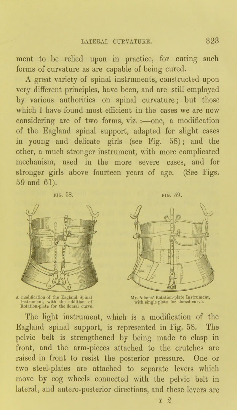 ment to be relied upon in practice, for curing sucli forms of curvature as are capable of being cured. A great variety of spinal instruments, constructed upon very different principles, have been, and are still employed by various authorities on spinal curvature; but those which I have found most efficient in the cases we are now considering are of two forms, viz. :—one, a modification of the Eagland spinal support, adapted for slight cases in young and delicate girls (see Fig. 58); and the other, a much stronger instrument, with more complicated mechanism, used in the more severe cases, and for stronger girls above fourteen years of age. (See Figs. 59 and Gl). FIG. 58. FIG. 59. A modification of tlie Eagland Spinal InstniiiicMt, with tlic addition of Rotation-plate for the dorsal cun'c. Mr. Adams' Eotation-plate Instrument, with single plate for dorsal curve. The light instrument, which is a modification of the Eagland spinal support, is represented in Fig. 58. The pelvic belt is strengthened by being made to clasp in front, and the arm-pieces attached to the crutches are raised in front to resist the posterior pressure. One or two steel-plates are attached to separate levers which move by cog wheels connected with the pelvic belt in lateral, and antero-posterior directions, and these levers are