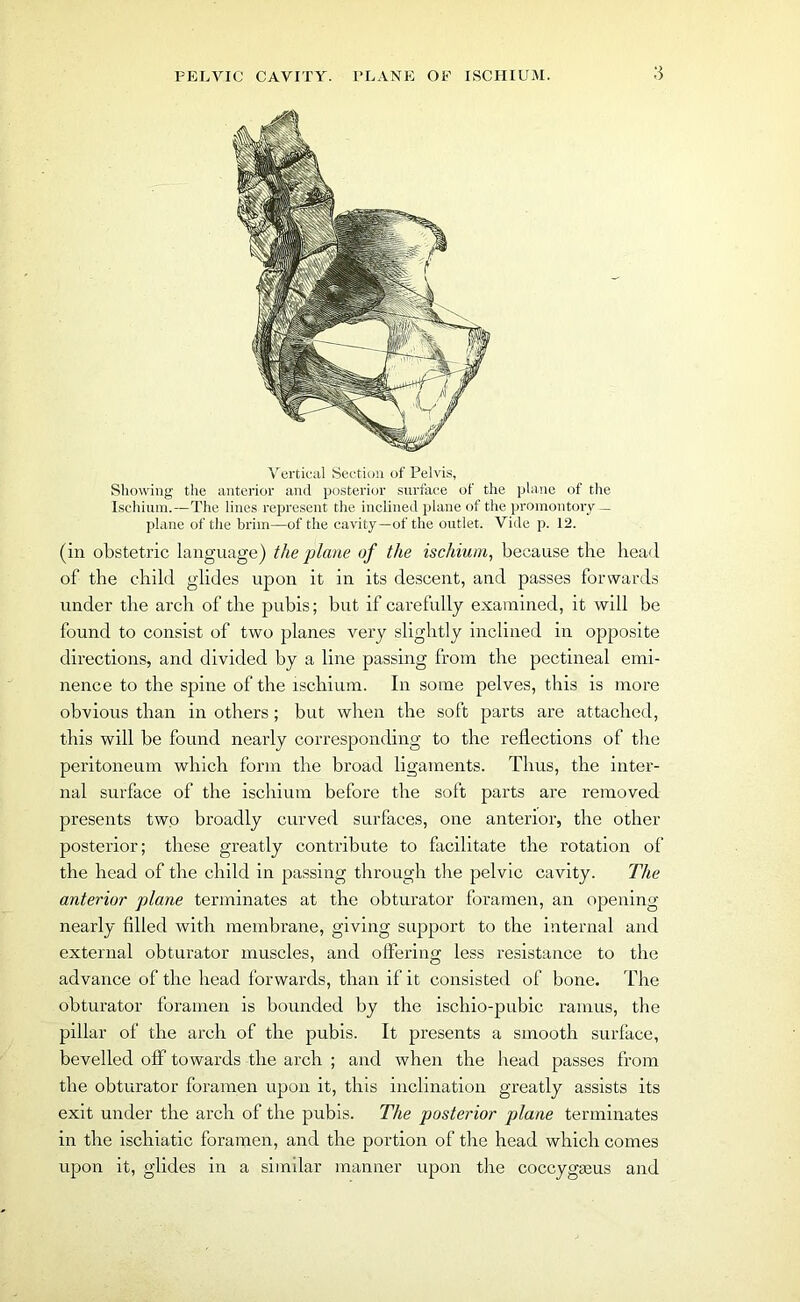 Vertical Section of Pelvis, Showing the anterior and posterior surface of the plane of the Ischium.—The lines represent the inclined plane of the promontory — plane of the brim—of the cavity—of the outlet. Vide p. 12. (in obstetric language) the plane of the ischium, because the head of the child glides upon it in its descent, and passes forwards under the arch of the pubis; but if carefully examined, it will be found to consist of two planes very slightly inclined in opposite directions, and divided by a line passing from the pectineal emi- nence to the spine of the ischium. In some pelves, this is more obvious than in others; but when the soft parts are attached, this will be found nearly corresponding to the reflections of the peritoneum which form the broad ligaments. Thus, the inter- nal surface of the ischium before the soft parts are removed presents two broadly curved surfaces, one anterior, the other posterior; these greatly contribute to facilitate the rotation of the head of the child in passing through the pelvic cavity. The anterior plane terminates at the obturator foramen, an opening nearly filled with membrane, giving support to the internal and external obturator muscles, and offering less resistance to the advance of the head forwards, than if it consisted of bone. The obturator foramen is bounded by the ischio-pubic ramus, the pillar of the arch of the pubis. It presents a smooth surface, bevelled off towards the arch ; and when the head passes from the obturator foramen upon it, this inclination greatly assists its exit under the arch of the pubis. The posterior plane terminates in the ischiatic foramen, and the portion of the head which comes upon it, glides in a similar manner upon the coccyga3us and