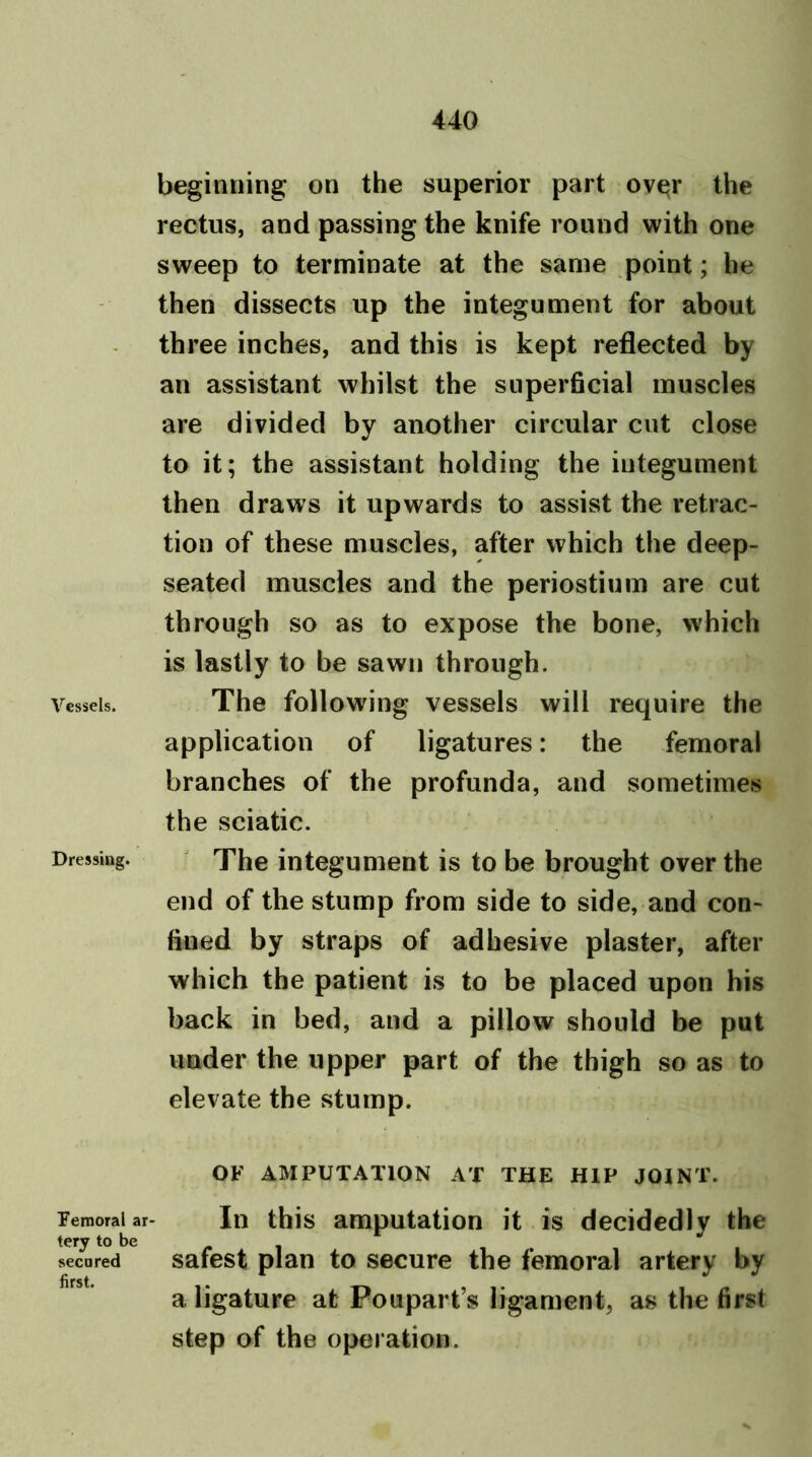 Vessels. Dressing. Femoral ar- tery to be secured first. beginning* on the superior part ov^r the rectus, and passing the knife round with one sweep to terminate at the same point; he then dissects up the integument for about three inches, and this is kept reflected by an assistant whilst the superficial muscles are divided by another circular cut close to it; the assistant holding the integument then draws it upwards to assist the retrac- tion of these muscles, after which the deep- seated muscles and the periostium are cut through so as to expose the bone, which is lastly to be sawn through. The following vessels will require the application of ligatures: the femoral branches of the profunda, and sometimes the sciatic. The integument is to be brought over the end of the stump from side to side, and con- fined by straps of adhesive plaster, after which the patient is to be placed upon his back in bed, and a pillow should be put under the upper part of the thigh so as to elevate the stump. OF AMPUTATION AT THE HIP JOINT. In this amputation it is decidedly the safest plan to secure the femoral artery by a ligature at Poupart’s ligament, as the first step of the operation.