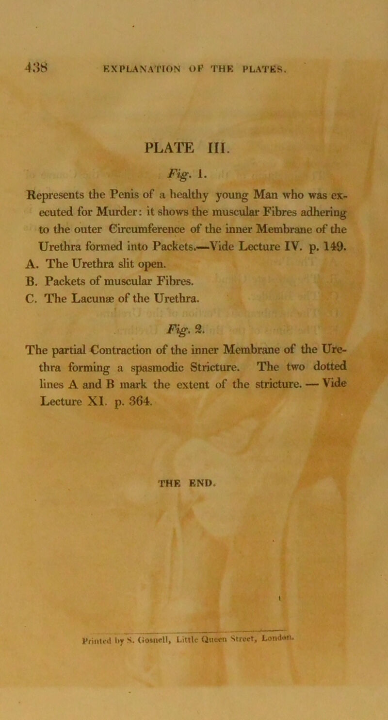 PLATE III. Fi^. 1. Represents the Penis of a healthy young Man who was ex- ecuted for Murder: it shows the muscular Fibres adhering to the outer Circumference of the inner Membrane of the Urethra formed into Packets.—Vide Lecture IV. p. 149. A. The Urethra slit open. B. Packets of muscular Fibres, C. The Lacunse of the Urethra. Fig. 3. The partial Contraction of the inner Membrane of the Ure- thra forming a spasmodic Stricture. The two dotted lines A and B mark the extent of the stricture. — Vide Lecture XI. p. 364. THE END. I I'rinted i»y S. {iosuell, Little Quern Street, LondtwL