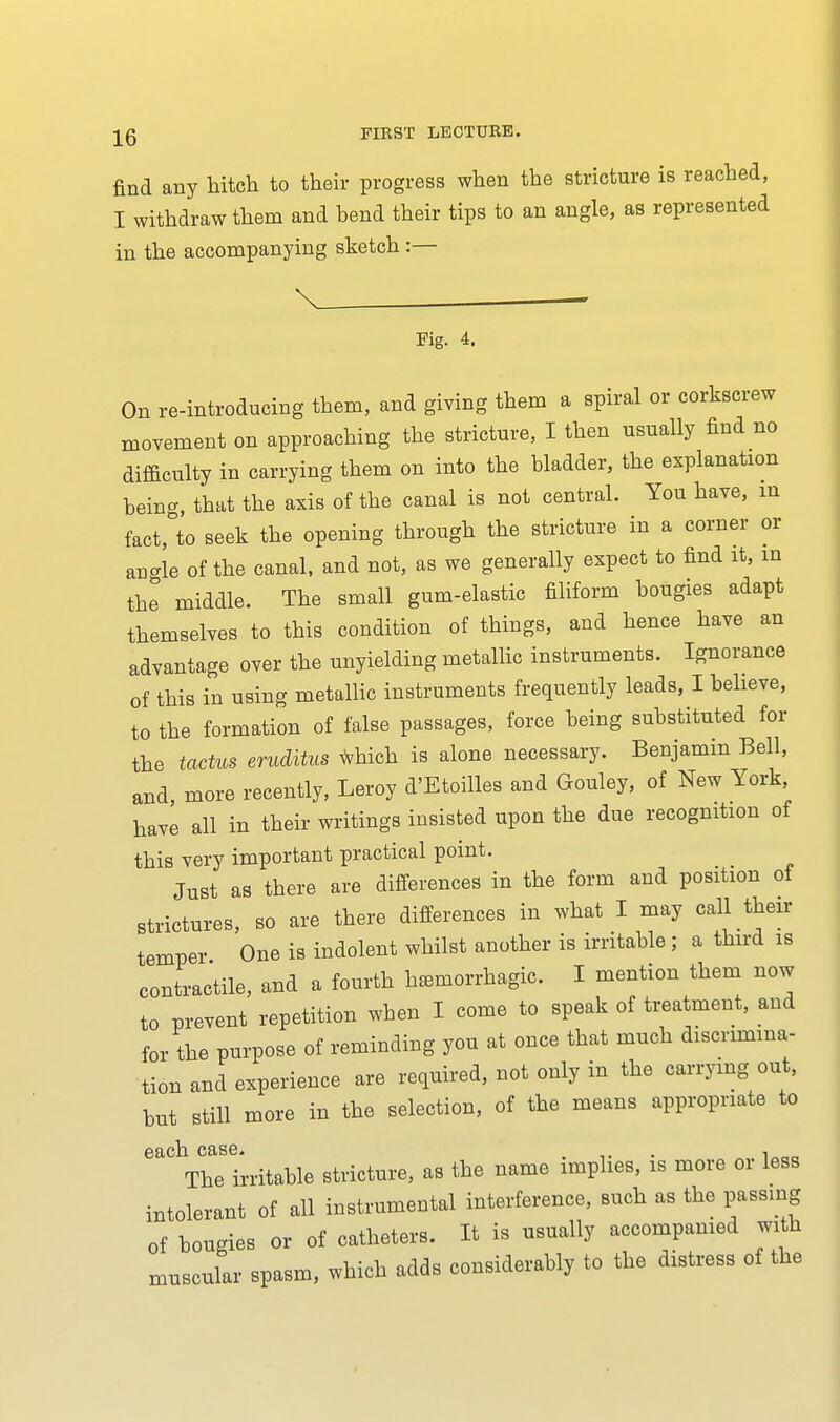 find any hitch to their progress when the stricture is reached, I withdraw them and bend their tips to an angle, as represented in the accompanying sketch :— Fig. 4. On re-introducing them, and giving them a spiral or corkscrew movement on approaching the stricture, I then usually find no difficulty in carrying them on into the bladder, the explanation being, that the axis of the canal is not central. You have, in fact, to seek the opening through the stricture in a corner or angle of the canal, and not, as we generally expect to find it, m the middle. The small gum-elastic filiform bougies adapt themselves to this condition of things, and hence have an advantage over the unyielding metallic instruments. Ignorance of this in using metallic instruments frequently leads, I believe, to the formation of false passages, force being substituted for the tactus eruditus which is alone necessary. Benjamin Bell, and, more recently, Leroy d'Etoilles and Gouley, of New York, have all in their writings insisted upon the due recognition of this very important practical point. Just as there are differences in the form and position of strictures, so are there differences in what I may call their temper One is indolent whilst another is irritable ; a third is contractile, and a fourth hemorrhagic. I mention them now to prevent repetition when I come to speak of treatment, and for the purpose of reminding you at once that much discrimina- tion and experience are required, not only in the carrying out, but still more in the selection, of the means appropriate to each case. .... i „_ The irritable stricture, as the name implies, is more or less intolerant of all instrumental interference, such as the passing of bougies or of catheters. It is usually accompanied with muscular spasm, which adds considerably to the distress of the