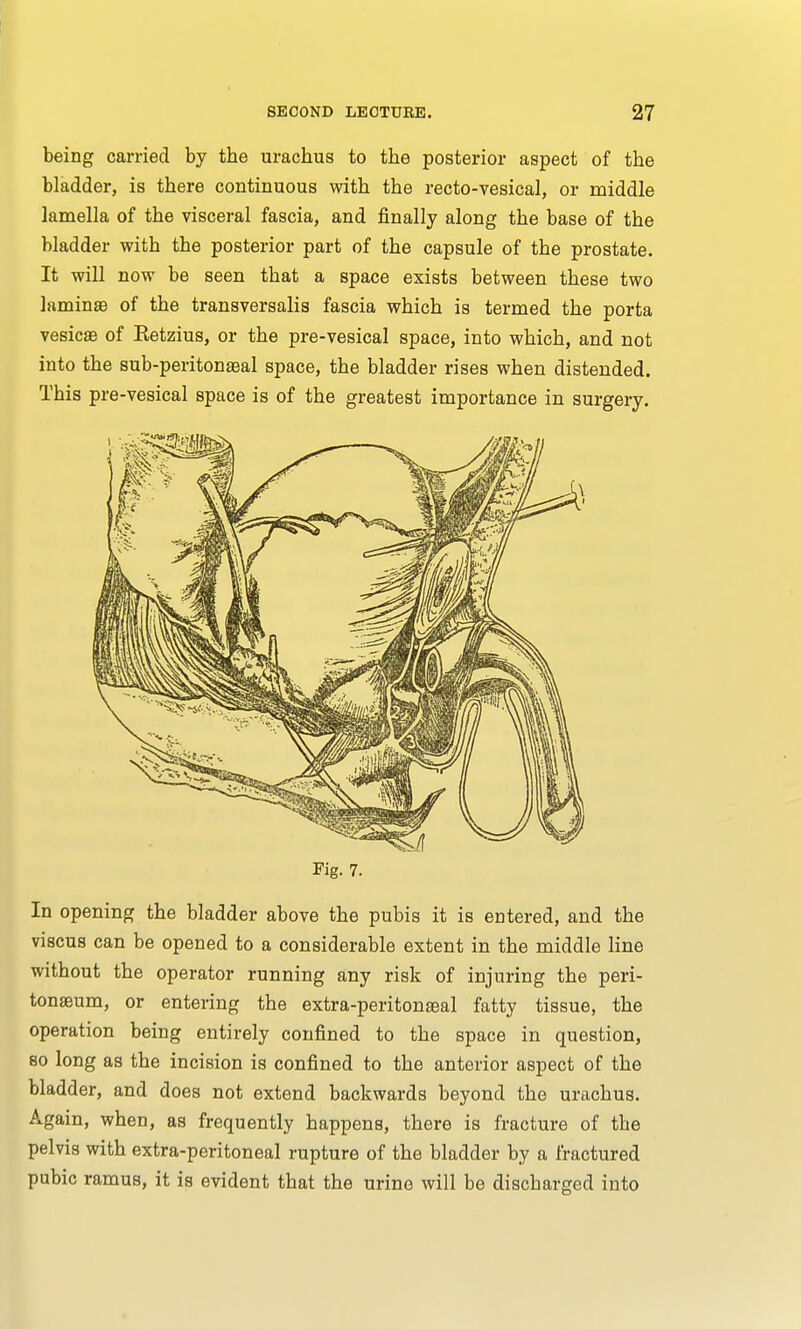 being carried by tbe uracbus to tbe posterior aspect of tbe bladder, is tbere continuous witb the recto-vesical, or middle lamella of tbe visceral fascia, and finally along tbe base of tbe bladder witb the posterior part of tbe capsule of the prostate. It will now be seen that a space exists between these two lamina? of the transversalis fascia which is termed the porta vesica? of Eetzius, or tbe pre-vesical space, into which, and not into the sub-peritonaeal space, the bladder rises when distended. This pre-vesical space is of the greatest importance in surgery. Fig. 7. In opening tbe bladder above tbe pubis it is entered, and the viscus can be opened to a considerable extent in the middle line without the operator running any risk of injuring the peri- tonaeum, or entering the extra-peritonaeal fatty tissue, the operation being entirely confined to the space in question, so long as the incision is confined to tbe anterior aspect of the bladder, and does not extend backwards beyond tbe urachus. Again, when, as frequently happens, there is fracture of tbe pelvis with extra-peritoneal rupture of the bladder by a fractured pubic ramus, it is evident that the urine will be discharged into