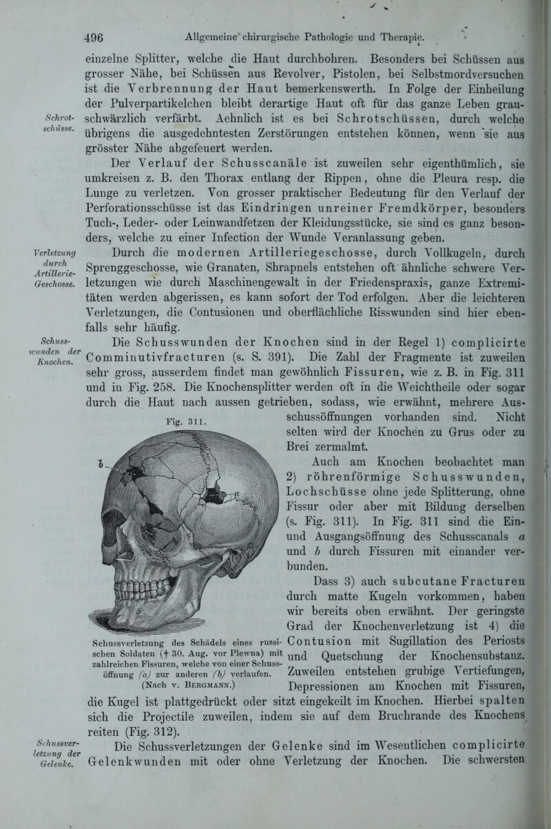 Schrot- schüsse. Verletzung durch Artillerie- Geschosse. Schuss- imtnden der Knochen. Schussver- letzung der Gelenke. 496 Allgemeine chirurgische Pathologie und Therapie. einzelne Splitter, welche die Haut durchbohren. Besonders bei Schüssen aus grosser Nähe, bei Schüssen aus Revolver, Pistolen, bei Selbstmordversuchen ist die Verbrennung der Haut bemerkenswerth. In Folge der Einheilung der Pulverpartikelchen bleibt derartige Haut oft für das ganze Leben grau- schwärzlich verfärbt. Aehnlich ist es bei Schrotschüssen, durch welche übrigens die ausgedehntesten Zerstörungen entstehen können, wenn 'sie aus grösster Nähe abgefeuert werden. Der Verlauf der Schusscanäle ist zuweilen sehr eigentümlich, sie umkreisen z. B. den Thorax entlang der Rippen, ohne die Pleura resp. die Lunge zu verletzen. Von grosser praktischer Bedeutung für den Verlauf der Perforationsschüsse ist das Eindringen unreiner Fremdkörper, besonders Tuch-, Leder- oder Leinwandfetzen der Kleidungsstücke, sie sind es ganz beson- ders, welche zu einer Infection der Wunde Veranlassung geben. Durch die modernen Artilleriegeschosse, durch Vollkugeln, durch Sprenggeschosse, wie Granaten, Shrapnels entstehen oft ähnliche schwere Ver- letzungen wie durch Maschinengewalt in der Friedenspraxis, ganze Extremi- täten werden abgerissen, es kann sofort der Tod erfolgen. Aber die leichteren Verletzungen, die Contusionen und oberflächliche Risswunden sind hier eben- falls sehr häufig. Die Schusswunden der Knochen sind in der Regel 1) complicirte Comminutivfracturen (s. S. 391). Die Zahl der Fragmente ist zuweilen sehr gross, ausserdem findet man gewöhnlich Fissuren, wie z. B. in Fig. 311 und in Fig. 258. Die Knochensplitter werden oft in die Weichtheile oder sogar durch die Haut nach aussen getrieben, sodass, wie erwähnt, mehrere Aus- schussöffnungen vorhanden sind. Nicht selten wird der Knochen zu Grus oder zu Brei zermalmt. Auch am Knochen beobachtet man 2) röhrenförmige Schusswunden, Lochschüsse ohne jede Splitterung, ohne Fissur oder aber mit Bildung derselben (s. Fig. 311). In Fig. 311 sind die Ein- und Ausgangsöffnung des Schusscanals a und b durch Fissuren mit einander ver- bunden. Dass 3) auch subcutane Fracturen durch matte Kugeln Vorkommen, haben wir bereits oben erwähnt. Der geringste Grad der Knochenverletzung ist 4) die Schussverletzung des Schädels eines russi- Coiltusion mit Sllglllation des Pei’lOStS sehen Soldaten (+ 30. Aug. vor Piewna) mit un(j Quetschung der Knochensubstanz, zahlreichen Fissuren, welche von einer Schuss- , . . „ . „ Öffnung faj zur anderen fbj verlaufen. ZuWGllGIl GütstGlIGD grilblgG \ GrtlGlUngGD, (Nach v. Bergmann.) Depressionen am Knochen mit Fissuren, die Kugel ist plattgedrückt oder sitzt eingekeilt im Knochen. Hierbei spalten sich die Projectile zuweilen, indem sie auf dem Bruchrande des Knochens reiten (Fig. 312). Die Schussverletzungen der Gelenke sind im Wesentlichen complicirte Gelenk wunden mit oder ohne Verletzung der Knochen. Die schwersten