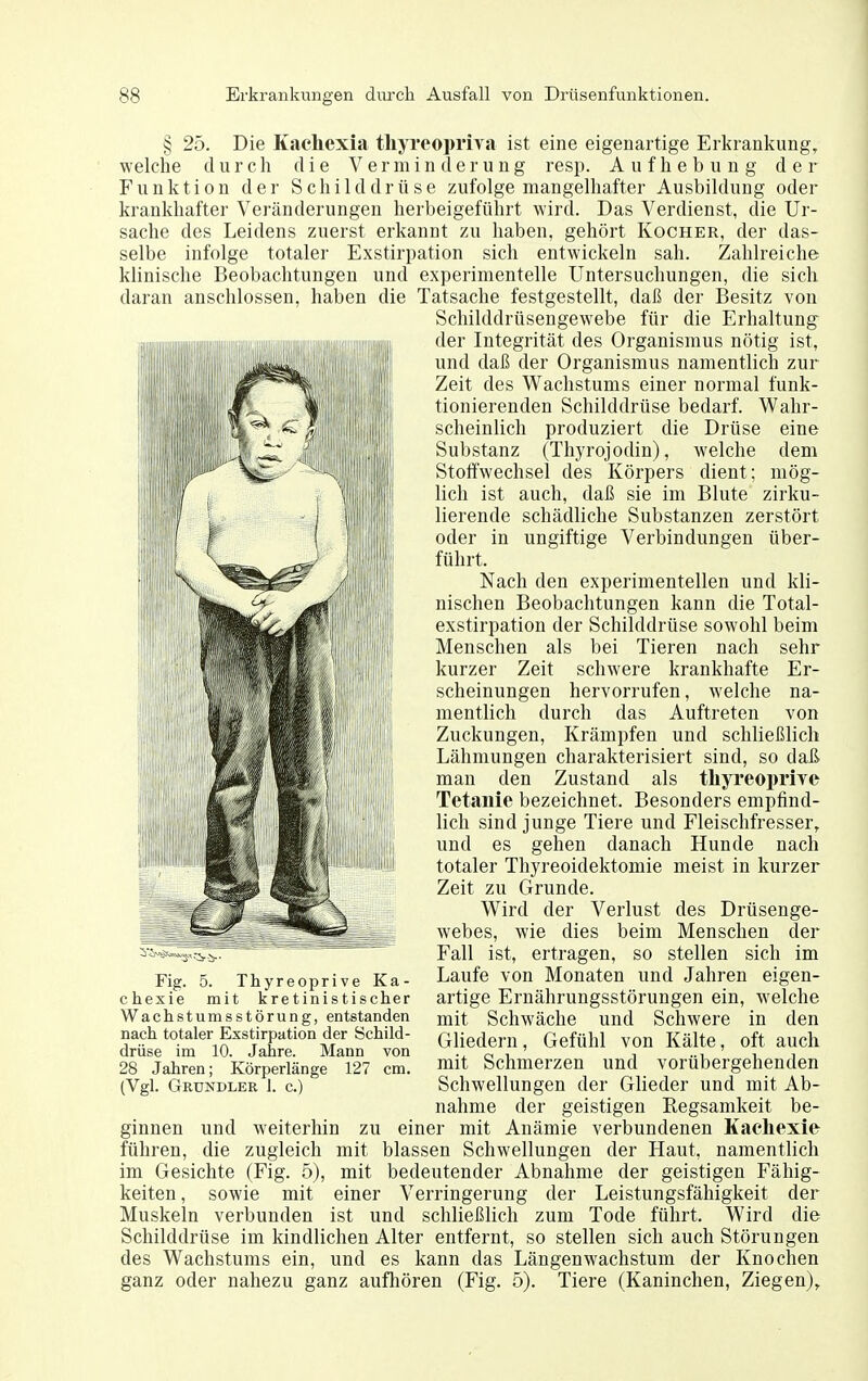 § 25. Die Kaehexia tliyreopriva ist eine eigenartige Erkrankung, welche durch die Verminderung resp. Aufhebung der Funktion der Schilddrüse zufolge mangelhafter Ausbildung oder krankhafter Veränderungen herbeigeführt wird. Das Verdienst, die Ur- sache des Leidens zuerst erkannt zu haben, gehört Kocher, der das- selbe infolge totaler Exstirpation sich entwickeln sah. Zahlreiche klinische Beobachtungen und experimentelle Untersuchungen, die sich daran anschlössen, haben die Tatsache festgestellt, daß der Besitz von Schilddrüsengewebe für die Erhaltung der Integrität des Organismus nötig ist, und daß der Organismus namentlich zur Zeit des Wachstums einer normal funk- tionierenden Schilddrüse bedarf. Wahr- scheinlich produziert die Drüse eine Substanz (Thyrojodin), welche dem Stoffwechsel des Körpers dient; mög- lich ist auch, daß sie im Blute zirku- lierende schädliche Substanzen zerstört oder in ungiftige Verbindungen über- führt. Nach den experimentellen und kli- nischen Beobachtungen kann die Total- exstirpation der Schilddrüse sowohl beim Menschen als bei Tieren nach sehr kurzer Zeit schwere krankhafte Er- scheinungen hervorrufen, welche na- mentlich durch das Auftreten von Zuckungen, Krämpfen und schließlich Lähmungen charakterisiert sind, so daß man den Zustand als thyi'eoprire Tetanie bezeichnet. Besonders empfind- lich sind junge Tiere und Fleischfresser, und es gehen danach Hunde nach totaler Thyreoidektomie meist in kurzer Zeit zu Grunde. Wird der Verlust des Drüsenge- webes, wie dies beim Menschen der Fall ist, ertragen, so stellen sich im Laufe von Monaten und Jahren eigen- artige Ernährungsstörungen ein, welche mit Schwäche und Schwere in den Gliedern, Gefühl von Kälte, oft auch mit Schmerzen und vorübergehenden Schwellungen der Glieder und mit Ab- nahme der geistigen Regsamkeit be- ginnen und weiterhin zu einer mit Anämie verbundenen Kachexie fiihren, die zugleich mit blassen Schwellungen der Haut, namentlich im Gesichte (Fig. 5), mit bedeutender Abnahme der geistigen Fällig- keiten, sowie mit einer Verringerung der Leistungsfähigkeit der Muskeln verbunden ist und schließlich zum Tode führt. Wird die Schilddrüse im kindlichen Alter entfernt, so stellen sich auch Störungen des Wachstums ein, und es kann das Längenwachstum der Knochen ganz oder nahezu ganz aufhören (Fig. 5). Tiere (Kaninchen, Ziegen), Fig. 5. Thyreoprive Ka- chexie mit kretinistischer Wachstumsstörung, entstanden nach totaler Exstirpation der Schild- drüse im 10. Jahre. Mann von 28 Jahren; Körperlänge 127 cm. (Vgl. Grundler 1. c.)