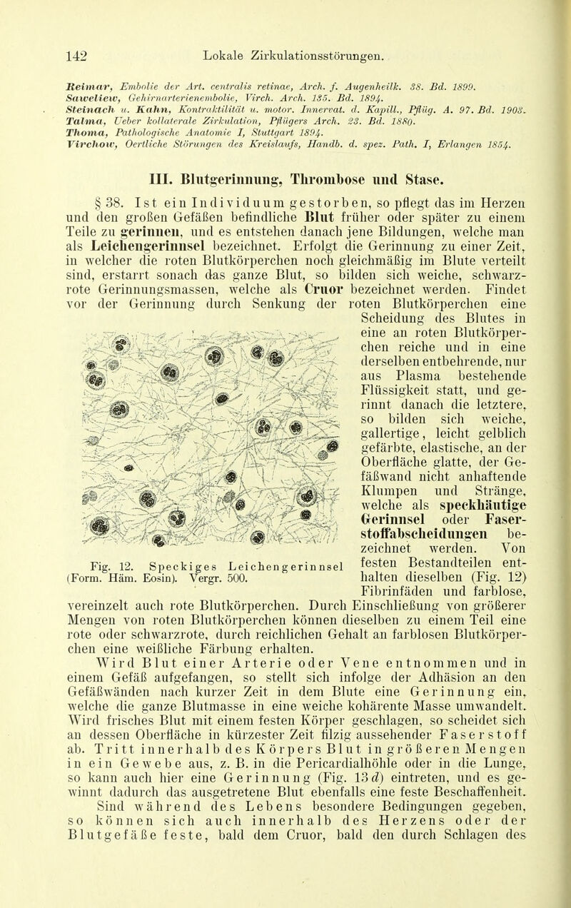 Reimar, Embnlie der Art. centralis retinae, Arch. f. Augenheilk. 38. Bd. 1899. Saweliew, Gehirnarterienembolie, Virch. Arch. 1S5. Bd. 1894, Steinach u. Kahn, Kontraktilität u. motor. Innervat. d. Kapill., Pflüg. A. 97. Bd. 190S. Talma, Ueber kollaterale Zirkulation, Pfliigers Arch. 23. Bd. 188o. Thoma, Pathologische Anatomie I, Stuttgart 1894. Virchow, Oertliche Störungen des Kreislaufs, Handb. d. spez. Path. I, Erlangen 1854. III. Blutgerinnung, Thromlbose und Stase. §38. Ist ein Individuum gestorben, so pflegt das im Herzen und den großen Gefäßen befindliche Blut früher oder später zu einem Teile zu gerinnen, und es entstehen danach jene Bildungen, welche man als Leicfiengerinnsel bezeichnet. Erfolgt die Gerinnung zu einer Zeit, in welcher die roten Blutkörperchen noch gleichmäßig im Blute verteilt sind, erstarrt sonach das ganze Blut, so bilden sich weiche, schwarz- rote Gerinnungsmassen, welche als Cruor bezeichnet werden. Findet vor der Gerinnung durch Senkung der roten Blutkörperchen eine Scheidung des Blutes in eine an roten Blutkörper- chen reiche und in eine derselben entbehrende, nur aus Plasma bestehende Flüssigkeit statt, und ge- rinnt danach die letztere^ so bilden sich weiche, gallertige, leicht gelblich gefärbte, elastische, an der Oberfläche glatte, der Ge- fäßwand nicht anhaftende Klumpen und Stränge, welche als speckliäutige Oerinnsel oder Faser- stoifabsclieidungen be- zeichnet werden. Von festen Bestandteilen ent- halten dieselben (Fig. 12) Fibrinfäden und farblose, vereinzelt auch rote Blutkörperchen. Durch Einschließung von größerer Mengen von roten Blutkörperchen können dieselben zu einem Teil eine rote oder schwarzrote, durch reichlichen Gehalt an farblosen Blutkörper- chen eine weißliche Färbung erhalten. Wird Blut einer Arterie oder Vene entnommen und in einem Gefäß aufgefangen, so stellt sich infolge der Adhäsion an den Gefäßwänden nach kurzer Zeit in dem Blute eine Gerinnung ein, welche die ganze Blutmasse in eine weiche kohärente Masse umwandelt. Wird frisches Blut mit einem festen Körper geschlagen, so scheidet sich an dessen Oberfläche in kürzester Zeit filzig aussehender Faserstoff ab. Tritt innerhalb des Körpers Blut in größeren Mengen in ein Gewebe aus, z. B. in die Pericardialhöhle oder in die Lunge, so kann auch hier eine Gerinnung (Fig. \^d) eintreten, und es ge- winnt dadurch das ausgetretene Blut ebenfalls eine feste Beschaffenheit. Sind während des Lebens besondere Bedingungen gegeben, so können sich auch innerhalb des Herzens oder der Blutgefäße feste, bald dem Cruor, bald den durch Schlagen des Fig. 12. Speckiges Leichengerinnsel (Form. Häm. Eosin). Vergr. 500.