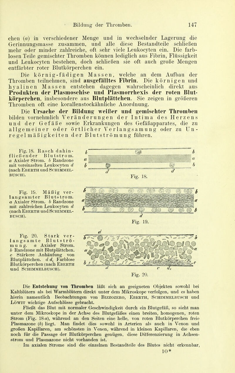 cheu (a) in verschiedener Menge und in wechselnder Lagerung die Gerinnungsmasse zusammen, und alle diese Bestandteile schließen mehr oder minder zahlreiche, oft sehr viele Leukocyten ein. Die farb- losen Teile gemischter Thromben können lediglich aus Fibrin, Flüssigkeit und Leukocyten bestehen, doch schließen sie oft auch große Mengen entfärbter roter Blutkörperchen ein. Die körnig-fädigen Massen, welche an dem Aufbau der Thromben teilnehmen, sind ausg-efälltes Fibrin. Die körnigen und hyalinen Massen entstehen dagegen wahrscheinlich direkt aus Produkten der Plasmoseliise und Plasmorrhexis der roten Blut- körperclien, insbesondere aus Blutplättclien. Sie zeigen in größeren Thromben oft eine korallenstockähnliche Anordnung. Die Ursaclie der Bildung weißer und gemiscliter Tlironiben bilden vornehmlich Veränderungen der Intima des Herzens und der Gefäße sowie Erkrankungen des Gefäßapparates, die zu allgemeiner oder örtlicher Verlangsamung oder zu Un- regelmäßigkeiten der Blutströmung führen. Fig. 18. Rasch dahin- fließender Blutstrom. a Axialer Strom, b Randzone mit vereinzeltea Leukocyten d (nach Ebeuth und Sohimmel- BUSCH). Fig. 18. ff Fig. IG. Mäßig ver- langsamter Blutstrom. « Axialer Strom, b Randzone mit zahlreichen Leukocyten d {nach Eberth und Schimmel- busch). Fig. 19. Fig. 20. Stark ver- langsamte Blutströ- mung, a Axialer Strom. b Randzone mit Blutplättchen. e Stärkere Anhäufung von Blutplättchen, d rf. Farblose Blutkörperchen (nach Eberth und Schimmelbusch). 'C Fig. 20. Die Entstehung von Thromben läßt sich an geeigneten Objekten sowohl bei Kaltblütern als bei Warmblütern direkt unter dem Mikroskope verfolgen, und es haben hierin namentlich Beobachtungen von Bizzozero, Eberth, Schimmelbusch und LöwiT wichtige Aufschlüsse gebracht. Fließt das Blut mit normaler Geschwindigkeit durch ein Blutgefäß, so sieht man unter dem Mikroskope in der Achse des Blutgefäßes einen breiten, homogenen, roten Strom (Fig. 18 a), während an den Seiten eine helle, von roten Blutkörperchen freie Plasmazone (6) liegt. Man findet dies sowohl in Arterien als auch in Venon und großen Kapillaren, am schönsten in Venen, während in kleinen Kapillaren, die eben noch für die Passage der Blutkörperchen genügen, diese Differenzierung in Achsea- strom und Plasmazone nicht vorhanden ist. Im axialen Strome sind die einzelnen Bestandteile des Blutes nicht erkennbar, 10*