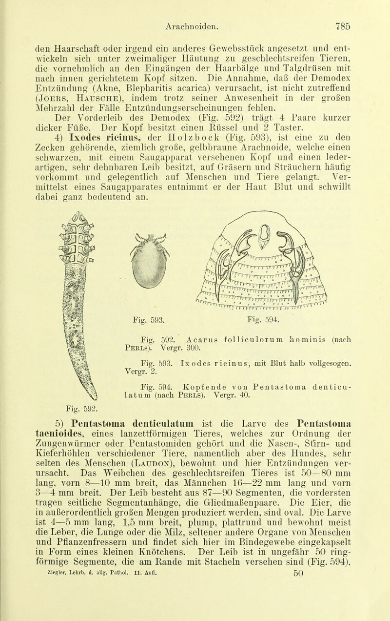 den Haarscliaft oder irgend ein anderes Gewebsstück angesetzt und ent- wickeln sich unter zweimaliger Häutung zu geschlechtsreifen Tieren, die vornehmlich an den Eingängen der Haarbälge und Talgdrüsen mit nach innen gerichtetem Kopf sitzen. Die Annahme, daß der Demodex Entzündung (Akne, Blepharitis acarica) verursacht, ist nicht zutreffend (JoERS, Hausche), indem trotz seiner Anwesenheit in der großen Mehrzahl der Fälle Entzüudungserscheinungen fehleu. Der Vorderleib des Demodex (Fig. 592) trägt 4 Paare kurzer dicker Füße. Der Kopf besitzt einen Rüssel und 2 Taster. 4) Ixodes ricinus, der Holz bock (Fig. 593), ist eine zu den Zecken gehörende, ziemlich große, gelbbraune Arachnoide, welche einen schwarzen, mit einem Saugapparat versehenen Kopf und einen leder- artigen, sehr dehnbaren Leib besitzt, auf Gräsern und Sträuchern häufig vorkommt und gelegentlich auf Menschen und Tiere gelangt. Ver- mittelst eines Saugapparates entnimmt er der Haut Blut und schwillt dabei ganz bedeutend an. 5) Pentastoma dentieulatum ist die Larve des Pentastouia taenioides, eines lanzettförmigen Tieres, welches zur Ordnung der Zungenwürmer oder Pentastomiden gehört und die Nasen-, Sürn- und Kieferhöhlen verschiedener Tiere, namentlich aber des Hundes, sehr selten des Menschen (Laudon), bewohnt und hier Entzündungen ver- ursacht. Das Weibchen des geschlechtsreifen Tieres ist 50—80 mm lang, vorn 8—10 mm breit, das Männchen 16—22 mm lang und vorn 3—4 mm breit. Der Leib besteht aus 87—90 Segmenten, die vordersten tragen seitliche Segmentanhänge, die Gliedmaßenpaare. Die Eier, die in außerordentlich großen Mengen produziert werden, sind oval. Die Larve ist 4—5 mm lang, 1,5 mm breit, plump, plattrund und bewohnt meist die Leber, die Lunge oder die Milz, seltener andere Organe von Menschen und Pflanzenfressern und findet sich hier im Bindegewebe eingekapselt in Form eines kleinen Knötchens. Der Leib ist in ungefähr 50 ring- förmige Segmente, die am Rande mit Stacheln versehen sind (Fig. 594), Zifgler, I.ehrb. d. allg. Pathol. 11. Aufl. 50 Fig. 592.