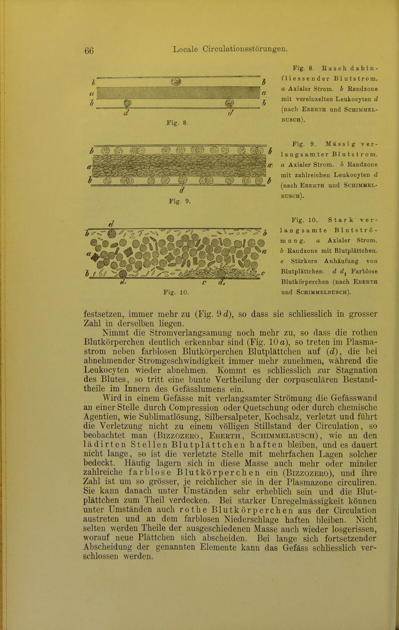 Fig. 8. Kaschdahin- fliessender Blutstrom. a Axialer Strom, b Randzone mit vereinzelten Leukocyten d (nach Eberth und Schimmel- Fig. 9. Massig ver- langsamter Blutstrom. a Axialer Strom, b Randzone mit zahlreichen Leukocyten d (nach Eberth und Schimmel- busch). d Fig. 10. Fig. 10. Stark ver- langsamte Blutströ- mung, a Axialer Strom. b Randzone mit Blutplättchen, c Stärkere Anhäufung von Blutplättchen, d d^ Farblose Blutkörperchen (nach Ebebth und Schimmelbusch). festsetzen, immer mehr zu (Fig. 9 d), so dass sie schliesslich in grosser Zahl in derselben liegen. Nimmt die Stromverlangsamung noch mehr zu, so dass die rothen Blutkörperchen deutlich erkennbar sind (Fig. 10 a), so treten im Plasma- strom neben farblosen Blutkörperchen Blutplättchen auf {ä), die bei abnehmender Stromgeschwindigkeit immer mehr zunehmen, während die Leukocyten wieder abnehmen. Kommt es schliesslich zur Stagnation des Blutes, so tritt eine bunte Vertheilung der corpusculären Bestand- theile im Innern des Gefässlumens ein. Wird in einem Gefässe mit verlangsamter Strömung die Gefässwand an einer Stelle durch Compression oder Quetschung oder durch chemische Agentien, wie Sublimatlösung, Silbersalpeter, Kochsalz, verletzt und führt die Verletzung nicht zu einem völligen Stillstand der Circulation, so beobachtet man (Bizzozero, Eberth, Schimmelbusch), wie an den lädirten Stellen Blutplättchen haften bleiben, und es dauert nicht lange, so ist die verletzte Stelle mit mehrfachen Lagen solcher bedeckt. Häufig lagern sich in diese Masse auch mehr oder minder zahlreiche farblose Blutkörperchen ein (Bizzozero), und ihre Zahl ist um so grösser, je reichlicher sie in der Plasmazone circuliren. Sie kann danach unter Umständen sehr erheblich sein und die Blut- plättchen zum Theil verdecken. Bei starker Unregelmässigkeit können unter Umständen auch rothe Blutkörperchen aus der Circulation austreten und an dem farblosen Niederschlage haften bleiben. Nicht selten werden Theile der ausgeschiedenen Masse auch wieder losgerissen, worauf neue Plättchen sich abscheiden. Bei lange sich fortsetzender Abscheidung der genannten Elemente kann das Gefäss schliesslich ver- schlossen werden.