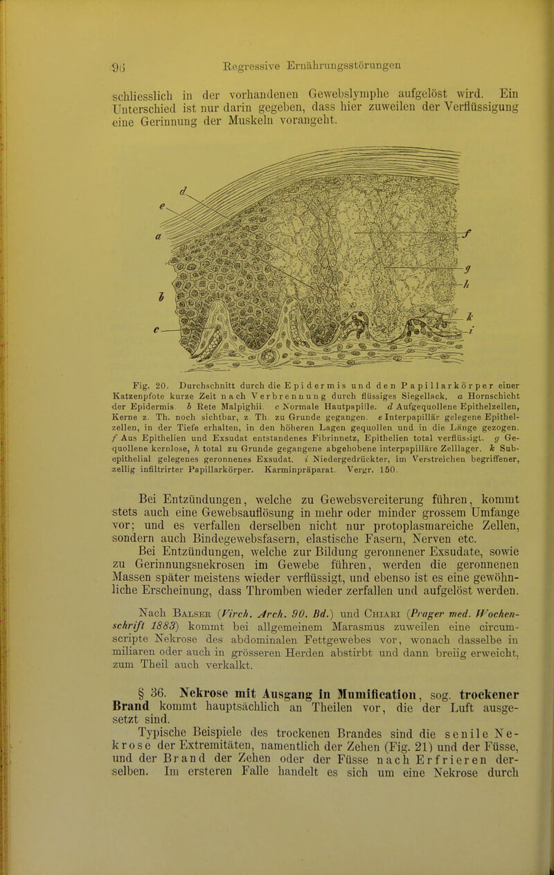 schliesslich in der vorhandenen Gewebslyniphe aufgelöst wird. Ein Unterschied ist nur darin gegeben, dass hier zuweilen der Verflüssigung eine Gerinnung der Muskeln vorangeht. Fig. 20. Durchschnitt durch die Epidermis und den Papillarkörper einer Katzenpfote kurze Zeit nach Verbrennung durch flüssiges SiegeUack. a Hornschicht der Epidermis, b Rete Malpighii. c Normale Hautpapille. d Aufgequollene Epithelzellen, Kerne z. Th. noch sichtbar, z. Th. zu Grunde gegangen, e Interpapillär gelegene Epithel- zellen, in der Tiefe erhalten, in den höheren Lagen gequollen und in die Länge gezogen. f Aus Epithelien und Exsudat entstandenes Fibrinnetz, Epithelien total verflüssigt, g Ge- quollene kernlose, h total zu Grunde gegangene abgehobene interpapilläre Zelllager, h Sub- opithelial gelegenes geronnenes Exsudat, i Niedergedrückter, im Verstreichen begriffener, zellig infiltrirter Papillarkörper. Karminpräparat. Vergr. 150. Bei Entzündungen, welche zu Gewebsvereiterung führen, kommt stets auch eine Gewebsauflösung in mehr oder minder grossem Umfange vor; und es verfallen derselben nicht nur protoplasmareiche Zellen, sondern auch Bindegewebsfasern, elastische Fasern, Nerven etc. Bei Entzündungen, welche zur Bildung geronnener Exsudate, sowie zu Gerinnungsnekrosen im Gewebe führen, werden die geronnenen Massen später meistens wieder verflüssigt, und ebenso ist es eine gewöhn- liche Erscheinung, dass Thromben wieder zerfallen und aufgelöst werden. Nach Balser {Firch. Jrch. 90. Bd.) und Chiari {Präger med. Wochen- schrift 1883) kommt bei allgemeinem Marasmus zuweilen eine circum- scripte Nekrose des abdominalen Fettgewebes vor, wonach dasselbe in miliaren oder auch in grösseren Herden abstirbt und dann breiig erweicht, zum Theil auch verkalkt. § 36. Nekrose mit Ausgang in Muniiiication, sog. trocicener Brand kommt hauptsächhch an Theilen vor, die der Luft ausge- setzt sind. Typische Beispiele des trockenen Brandes sind die senile Ne- krose der Extremitäten, namentlich der Zehen (Fig. 21) und der Füsse, und der Brand der Zehen oder der Füsse nach Erfrieren der- selben. Im ersteren Falle handelt es sich um eine Nekrose durch