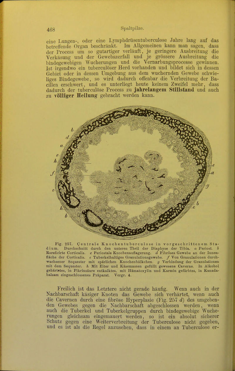 eine Lungen-, oder eine Lymplidrüsentuberculose Jahre lang auf das betreffende Organ beschränkt. Im Allgemeinen kann man sagen, dass der Process um so gutartiger verläuft, je geringere Ausbreitung die Verkäsung und der Gewebszerfall und je grössere Ausbreitung die bindegewebigen Wucherungen und die Vernarbungsprocesse gewinnen. Ist irgendwo ein tuberculöser Herd vorhanden und bildet sich in dessen Gebiet oder in dessen Umgebung aus dem wuchernden Gewebe schwie- liges Bindegewebe, so wird dadurch offenbar die Verbreitung der Ba- cillen erschwert, und es unterliegt heute keinem Zweifel mehr, dass dadurch der tuberculöse Process zu jahrelangem Stillstand und auch zu Tölliger Heilung gebracht werden kann. Fig. 257. Zentrale K n o ch e n tu b er c ul o se in vorgeschrittenem Sta- dium. Durchschnitt durch den unteren Theil der Diaphyse der Tibia. a Periost, b Rareficirte Corticalis. c Periostale Knochenauflagerung, d Fibröses Gewebe an der Innen- fläche der Corticalis. e Tuberkelhaltiges Granulationsgewebe, f Von Granulationen durch- wachsener Sequester mit spärlichen Knochenbälkchen. g Verbindung der Granulationen mit dem Sequester, h Mit Eiter und Käsemassen gefüllt gewesene Caverne. In Alkohol gehärtetes, in Pikrinsäure entkalktes, mit Hämatoxylin und Karmin gefärbtes, in Kanada- balsam eingeschlossenes Präparat. Vergr. 4. Freilich ist das Letztere nicht gerade häufig. Wenn auch in der Nachbarschaft käsiger Knoten das Gewebe sich verhärtet, wenn auch die Cavernen durch eine fibröse Hyperplasie (Fig. 257 d) des umgeben- den Gewebes gegen die Nachbarschaft abgeschlossen werden, wenn auch die Tuberkel und Tuberkelgruppen durch bindegewebige Wuche- rungen gleichsam eingemauert werden, so ist ein absolut sicherer Schutz gegen eine Weiterverbreitung der Tuberculöse nicht gegeben, und es ist als die Regel anzusehen, dass in einem an Tuberculöse er-
