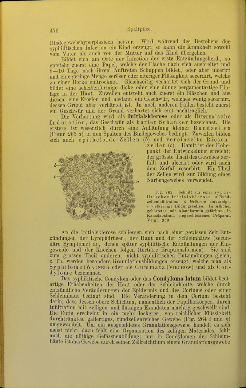 Bindegewebsliyperplasieen liervor. Wird während des Bestehens der syphilitischen Infection ein Kind erzeugt, so kann die Krankheit sowohl vom Vater als auch von der Mutter auf das Kind übergehen. Bildet sich am Orte der Infection der erste Entzündungsherd, so entsteht zuerst eine Papel, welche der Fläche nach sich ausbreitet und 8—10 Tage nach ihrem Auftreten Schuppen bildet, oder aber ulcerirt und eine geringe Menge seröser oder eiteriger Flüssigkeit secernirt, welche zu einer Borke eintrocknet. Gleichzeitig verhärtet sich der Grund und bildet eine scheibenförmige dicke oder eine dünne pergamentartige Ein- lage in der Haut. Zuweilen entsteht auch zuerst ein Bläschen und aus diesem eine Erosion und alsdann ein Geschwür, welches wenig secernirt, dessen Grund aber verhärtet ist. In noch anderen Fällen besteht zuerst ein Geschwür und der Grund verhärtet sich erst nachträglich. Die Verhärtung wird als Initialsklerose oder als Hunter'sc he Induration, das Geschwür als harter Schanker bezeichnet. Die erstere ist wesentlich durch eine Anhäufung kleiner Rundzellen (Figur 263 a) in den Spalten des Bindegewebes bedingt. Zuweilen bilden sich auch epitheloide Zellen (&) und vereinzelte Riesen- zellen (c). Damit ist der Höhe- punkt der Entwickelung erreicht; der grösste Theil des Gewebes zer- fällt und ulcerirt oder wird nach dem Zerfall resorbirt. Ein Theil der Zellen wird zur Bildung eines Narbengewebes verwendet. Fig. 263. Schnitt aus einer syphi- litischen Initialsklerose, a Rund- zelleninfiltration, b Grössere einkernige, c vielkernige Bildungszellen. In Alkohol gehärtetes, mit Alaunkarmin gefärbtes, in Kanadabalsam eingeschlossenes Präparat. Vergr. 350. An die Initialsklerose schliessen sich nach einer gewissen Zeit Ent- zündungen der Lymphdrüsen, der Haut und der Schleimhäute (secun- däre Symptome) an, denen später syphilitische Entzündungen der Ein- geweide und der Knochen folgen (tertiäre Eruptionsformen). Sie sind zum grossen Theil anderen, nicht syphilitischen Entzündungen gleich, z. Th. werden besondere Granulationsbildungen erzeugt, welche man als Syphilome (Wagner) oder als Gummata (Virchow) und als Con- dylome bezeichnet. Das syphilitische Condylom oder das Condyloma latum bildet beet- artige Erhabenheiten der Haut oder der Schleimhäute, welche durch entzündliche Veränderungen der Epidermis und des Coriums oder einer Schleimhaut bedingt sind. Die Veränderung in dem Corium besteht darin, dass dessen obere Schichten, namentlich der Papillarkörper, durch Infiltration mit zelligen und flüssigen Exsudaten mächtig geschwellt sind. Die Cutis erscheint in ein mehr lockeres, von reichlicher Flüssigkeit durchtränktes, gallertiges, rundzellenreiches Gewebe (Fig. 264 i und k) umgewandelt. Um ein ausgebildetes Granulationsgewebe handelt es sich meist nicht, dazu fehlt eine Organisation des zelligen Materiales, fehlt auch die nöthige Gefässneubildung; nur in Condylomen der Schleim- häute ist das Gewebe durch seinen Zellreichthuni einem Granulationsgewebe