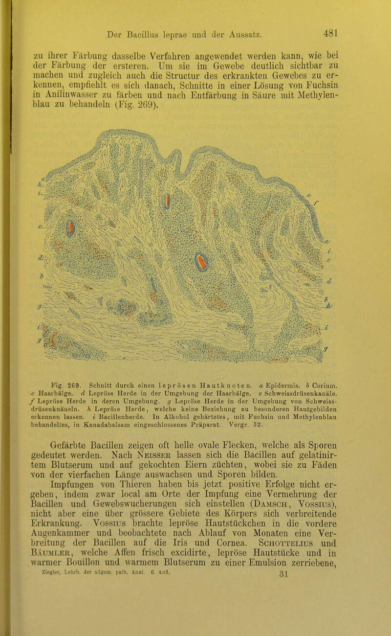zu ihrer Färbung dasselbe Verfahren angewendet werden kann, wie bei der Färbung der erstereu. Um sie im Gewebe deutlich sichtbar zu machen und zugleich auch die Structur des erkrankten Gewebes zu er- kennen, empfiehlt es sich danach, Schnitte in einer Lösung von Fuchsin in Anilinwasser zu färben und nach Entfärbung in Säure mit Methylen- blau zu behandeln (Fig. 269). Fig. 269. Schnitt durch einen leprösen Hautknoten, a Epidermis. S Corium. c Haarbälge, d Lepröse Herde in der Umgebung der Haarbälge, e Schweissdrüsenkanäle. / Lepröse Herde in deren Umgebung, g Lepröse Herde in der Umgebung von Schweiss- drüsenknäueln. h Lepröse Herde, welche keine Beziehung zu besonderen Hautgebilden erkennen lassen, i BaciUenherde. In Alkohol gehärtetes, mit Fuchsin und Methylenblau behandeltes, in Kanadabalsam eingeschlossenes Präparat. Vergr. 32. Gefärbte Bacillen zeigen oft helle ovale Flecken, welche als Sporen gedeutet werden. Nach Neisser lassen sich die Bacillen auf gelatinir- tem Blutsenim und auf gekochten Eiern züchten, wobei sie zu Fäden von der vierfachen Länge auswachsen und Sporen bilden. Impfungen von Thieren haben bis jetzt positive Erfolge nicht er- geben, indem zwar local am Orte der Impfung eine Vermehrung der Bacillen und Gewebswucherungen sich einstellen (Damsch, Vossius), nicht aber eine über grössere Gebiete des Körpers sich verbreitende Erkrankung. Vossius brachte lepröse Hautstückchen in die vordere Augenkammer und beobachtete nach Ablauf von Monaten eine Ver- breitung der Bacillen auf die Iris und Cornea. Schottelius und Bäumler, welche Affen frisch excidirte, lepröse Hautstücke und in warmer Bouillon und warmem Blutserum zu einer Emulsion zerriebene, ziegler, f.elirb. der .illgem. path. Anat. 6. Aufl. Ql