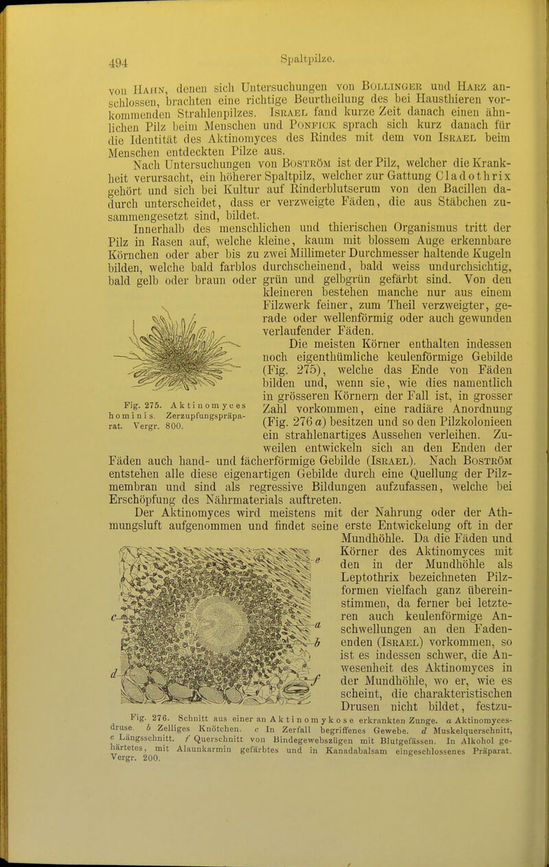 vou Hahn, denen sich Uutei-suchungen von Bollinger und Harz an- schlössen, brachten eine richtige Beurtheilung des bei Hausthieren vor- kommenden Strahlenpilzes. Israel fand kurze Zeit danach einen ähn- lichen Pilz beim Menschen und Poneick sprach sich kurz danach für die Identitcät des Aktiuomyces des Rindes mit dem von Israel beim Menschen entdeckten Pilze aus. Nach Untersuchungen von Boström ist der Pilz, welcher die Krank- heit verursacht, ein höherer Spaltpilz, welcher zur Gattung Cladothrix o-ehört und sich bei Kultur auf Rinderblutserum von den Bacillen da- durch unterscheidet, dass er verzweigte Fäden, die aus Stäbchen zu- sammengesetzt sind, bildet. Innerhalb des menschlichen und thierischen Organismus tritt der Pilz in Rasen auf, welche kleine, kaum mit blossem Auge erkennbare Körnchen oder aber bis zu zwei Millimeter Durchmesser haltende Kugeln bilden, welche bald farblos durchscheinend, bald weiss undurchsichtig, bald gelb oder braun oder grün und gelbgrün gefärbt sind. Von den kleineren bestehen manche nur aus einem Filzwerk feiner, ziun Theil verzweigter, ge- rade oder wellenförmig oder auch gewunden verlaufender Fäden. Die meisten Körner enthalten indessen noch eigenthümliche keulenförmige Gebilde (Fig. 275), welche das Ende von Fäden bilden und, wenn sie, wie dies namentlich in grösseren Körnern der Fall ist, in grosser Zahl vorkommen, eine radiäre Anordnung (Fig. 276 a) besitzen und so den Pilzkolonieen ein strahlenartiges Aussehen verleihen. Zu- weilen entwickeln sich an den Enden der Fäden auch hand- und fächerförmige Gebilde (Israel). Nach Boström entstehen alle diese eigenartigen Gebilde durch eine Quellung der Pilz- membran und sind als regressive Bildungen aufzufassen, welche bei Erschöpfung des Nährmaterials auftreten. Der Aktinomyces wird meistens mit der Nahrung oder der Ath- mungsluft aufgenommen und findet seine erste Entwickelung oft in der Mundhöhle. Da die Fäden und Körner des Aktinomyces mit den in der Mundhöhle als Leptothrix bezeichneten Pilz- formen vielfach ganz überein- stimmen, da ferner bei letzte- ren auch keulenförmige An- schwellungen an den Faden- enden (Israel) vorkommen, so ist es indessen schwer, die An- wesenheit des Aktinomyces in der Mundhöhle, wo er, wie es scheint, die charakteristischen Drusen nicht bildet, festzu- Fig. 276. Schnitt aus einer an A k t i n o m y k o s e erkrankten Zunge, o Aktinomyces- druse. b Zelliges Knötchen. c In Zerfall begriffenes Gewebe, d Muskelquerschnitt, e Längsschnitt. /Querschnitt von Bindegewebszügcn mit Blutgefässen. In Alkohol ge- härtetes, mit Alaunkarmin gefärbtes und in Kanadabalsam eingeschlossenes Präparat. Vergr. 200. Fig. 275. Aktinomyces hominis. Zerzupfungspräpa- rat. Vergr. 800.
