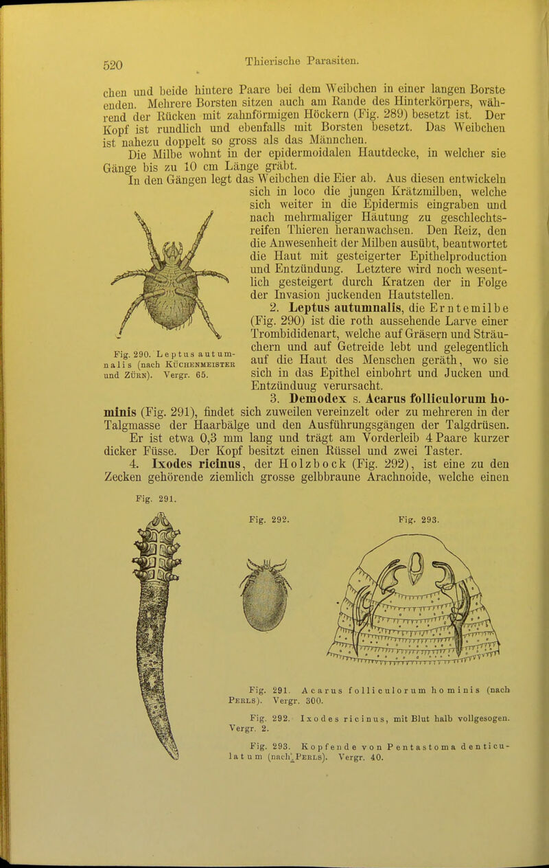 clien und beide hiutere Paare bei dem Weibchen in einer langen Borste enden. Mehrere Borsten sitzen auch am Rande des Hinterkörpers, wäh- rend der Rücken mit zahnförmigen Höckern (Fig. 289) besetzt ist. Der Kopf ist rundhch und ebenfalls mit Borsten besetzt. Das Weibchen ist nahezu doppelt so gross als das Männchen. Die Milbe wohnt in der epidermoidalen Hautdecke, in welcher sie Gänge bis zu 10 cm Länge gräbt. In den Gängen legt das Weibchen die Eier ab. Aus diesen entwickeln sich in loco die jungen Krätzmilben, welche sich weiter in die Epidermis eingraben und nach mehrmaliger Häutung zu geschlechts- reifen Thieren heranwachsen. Den Reiz, den die Anwesenheit der Milben ausübt, beantwortet die Haut mit gesteigerter Epithelproduction und Entzündung. Letztere wird noch wesent- lich gesteigert durch Kratzen der in Folge der Invasion juckenden Hautstellen. 2. Leptus autumnalis, die Erntemilbe (Fig. 290) ist die roth aussehende Larve einer Trombididenart, welche auf Gräsern und Sträu- chern und auf Getreide lebt und gelegentlich auf die Haut des Menschen geräth, wo sie sich in das Epithel einbohrt und Jucken und Entzünduug verursacht. 3. Demodex s. Acarus folliculorum ho- minis (Fig. 291), findet sich zuweilen vereinzelt oder zu mehi*eren in der Talgmasse der Haarbälge und den Ausführungsgängen der Talgdrüsen. Er ist etwa 0,3 mm lang und trägt am Vorderleib 4 Paare kurzer dicker Füsse. Der Kopf besitzt einen Rüssel und zwei Taster. 4. Ixodes ricinus, der Holzbock (Fig. 292), ist eine zu den Zecken gehörende ziemlich grosse gelbbraune Arachnoide, welche einen Fig. 290. Leptus autum- nalis (nach KÜCHENMEISTER und Zürn). Vergr. 65. Fig. 291. Fig. 292. Fig. 293. Fig. 291. Acarus folliculorum hominis (nach Perls). Vergr. 300. Fig. 292. Ixodes ricinus, mit Blut halb vollgesogen. Vergr. 2. Fig. 293. Kopfende von Pentastoma denticu- 1 a t u m (nach^j^PERLs). Vergr. 40.