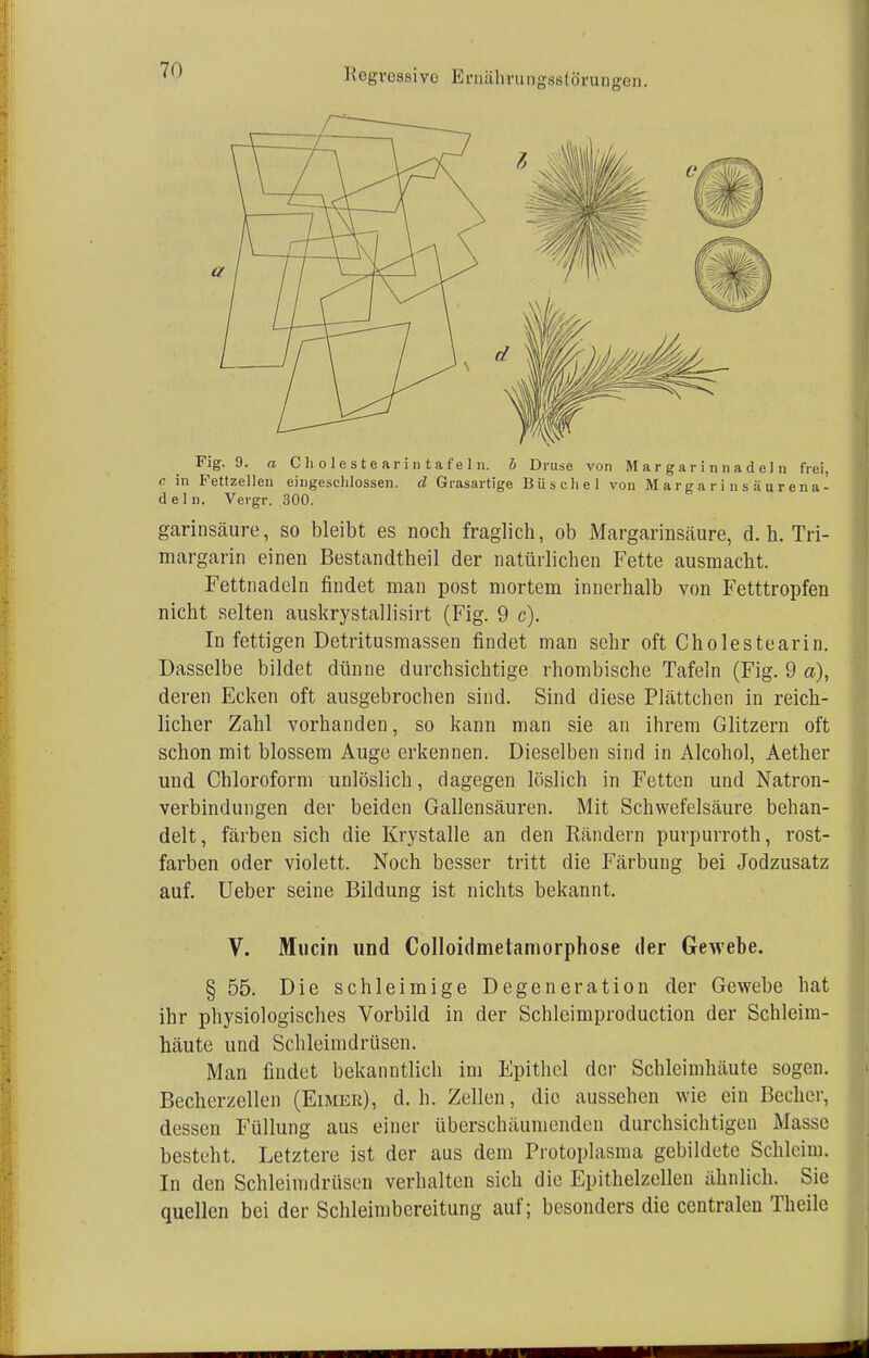 Fig. 9. a Cholestearintafeln. b Druse von Margarinnadel n frei, c in Fettzelleu eingeschlossen, d Grasartige Büschel von Margarinsäurena- deln. Vergr. 300. garinsäure, so bleibt es noch fraglich, ob Margarinsäure, d.h. Tri- margarin einen Bestandtheil der natürlichen Fette ausmacht. Fettnadeln findet man post mortem innerhalb von Fetttropfen nicht selten auskrystallisirt (Fig. 9 c). In fettigen Detritusmassen findet man sehr oft Cholestearin. Dasselbe bildet dünne durchsichtige rhombische Tafeln (Fig. 9 a), deren Ecken oft ausgebrochen sind. Sind diese Plättchen in reich- licher Zahl vorhanden, so kann man sie an ihrem Glitzern oft schon mit blossem Auge erkennen. Dieselben sind in Alcohol, Aether und Chloroform unlöslich, dagegen löslich in Fetten und Natron- verbindungen der beiden Gallensäuren. Mit Schwefelsäure behan- delt, färben sich die Krystalle an den Rändern purpurroth, rost- farben oder violett. Noch besser tritt die Färbung bei Jodzusatz auf. Ueber seine Bildung ist nichts bekannt. V. Mucin und Colloidmetamorphose der Gewebe. § 55. Die schleimige Degeneration der Gewebe hat ihr physiologisches Vorbild in der Schleimproduction der Schleim- häute und Schleimdrüsen. Man findet bekanntlich im Epithel der Schleimhäute sogen. Becherzellen (Eimer), d.h. Zellen, die aussehen wie ein Becher, dessen Füllung aus einer überschäumenden durchsichtigen Masse besteht. Letztere ist der aus dem Protoplasma gebildete Schleim. In den Schleimdrüsen verhalten sich die Epithelzellen ähnlich. Sie quellen bei der Schleimbereitung auf; besonders die centralen Theile