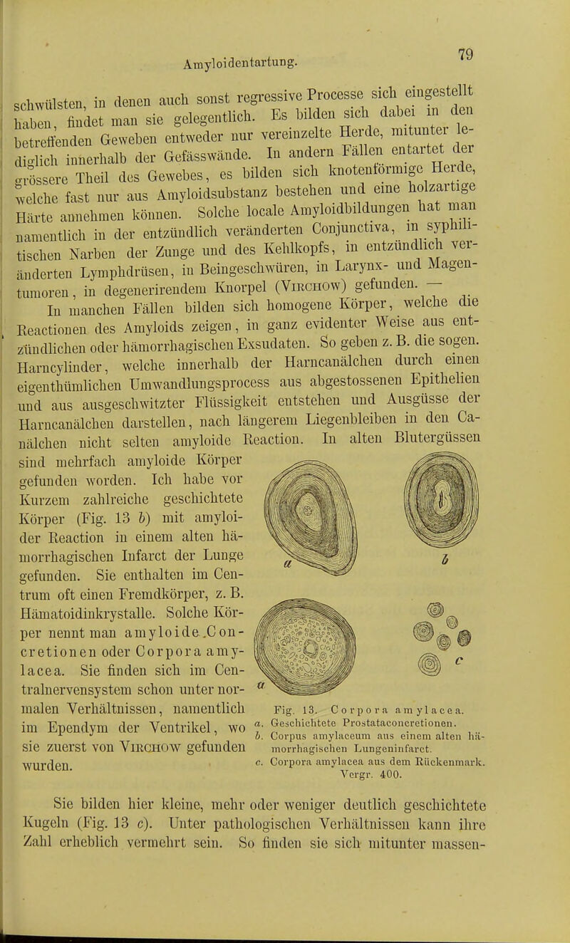 schwülsten in denen auch sonst regressive Processe sich eingestellt ha ^findet man sie gelegentlich. Es bilden sich dabei in den bettenden Geweben entweder nur vereinzelte Herde, mitunter e- dHidi innerhalb der Gefässwände. In andern Fällen entartet der ! ö sere Theil des Gewebes, es bilden sich knotentormige Herde Liehe fast nur aus Amyloidsubstanz bestehen und eine holzaitige Härte annehmen können. Solche locale Amyloidbildungen hat man namentlich in der entzündlich veränderten Conjunctiva, m syphili- tischen Narben der Zunge und des Kehlkopfs, m entzündlich ver- änderten Lymphdrüsen, in Beingeschwüren, in Larynx- und Magen- tumoren, in degenerirendem Knorpel (Virchow) gefunden - In manchen Fällen bilden sich homogene Körper, welche die Reactionen des Amyloids zeigen, in ganz evidenter Weise aus ent- zündlichen oder hämorrhagischen Exsudaten. So geben z. B. die sogen. Harncylinder, welche innerhalb der Harncanälchen durch einen eigenthümlichen Umwandlungsprocess aus abgestossenen Epithelien und aus ausgeschwitzter Flüssigkeit entstehen und Ausgüsse der Harncanälchen darstellen, nach längerem Liegenbleiben in den Ca- nälchen nicht selten amyloide Reaction. In alten Blutergüssen sind mehrfach amyloide Körper gefunden worden. Ich habe vor Kurzem zahlreiche geschichtete Körper (Fig. 13 b) mit amyloi- der Reaction in einem alten hä- morrhagischen Infarct der Lunge gefunden. Sie enthalten im Cen- trum oft einen Fremdkörper, z. B. Hämatoidinkrystalle. Solche Kör- per nennt man amyloide .Con- cretionen oder Corpora amy- lacea. Sie finden sich im Cen- tralnervensystem schon unter nor- malen Verhältnissen, namentlich Fi g. 13. Corpora amylacea. im Ependym der Ventrikel, WO * Geschichtete Pro.tataconcrctionen. * J o. Corpus amylaccum aus einem altei sie zuerst von Virchow gefunden morrhagischen Lungeninf'aret ten hä- wurden. —0 —0 c. Corpora amylacea aus dein Rückenmark. Vergr. 400. Sie bilden hier kleine, mehr oder weniger deutlich geschichtete Kugeln (Fig. 13 c). Unter pathologischen Verhältnissen kann ihre Zahl erheblich vermehrt sein. So finden sie sich mitunter massen-