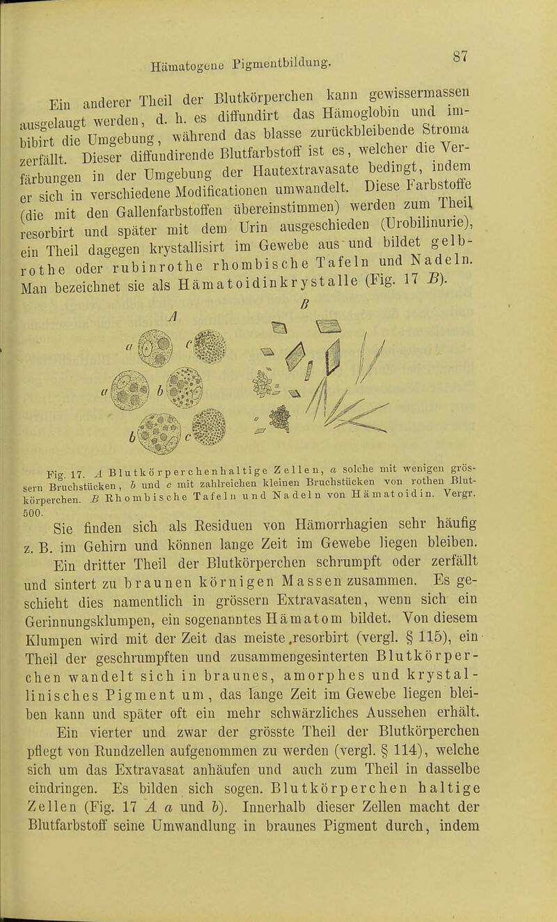 Hämatogene rigmeutbilclung. Fin anderer Theil der Blutkörperchen kann gcwissermassen „„innot werden d h. es diffundirt das Hämoglobin und im- SSJÄ « daS blaSSG -ückbleibende Stiwia tSt. Dieser diffnndirende Blutfarbstoff ist es, welcher die Ver- bringen in der Umgebung der Hautextravasate bedingt, indem er sich in verschiedene Modificationen umwandelt. Diese larbstoffe fdie mit den Gallenfarbstoffen übereinstimmen) werden zum Theil resorbirt und später mit dem Urin ausgeschieden (Urobilinurie), ein Theil dagegen krystallisirt im Gewebe aus und bildet gelb- rothe oder rubinrothe rhombische Tafeln und Nadeln. Man bezeichnet sie als Hämatoidinkr ystalle (Fig. 17 B). B A Fig 17 Ä Blutkörperchenhaltige Zellen, a solche mit wenigen grös- sern Bruchstücken , b und c mit zahlreichen kleinen Bruchstücken von rothen Blut- körperchen. B Rhombische Tafeln und Nadeln von Hämatoidin. Vergr. 500. . . Sie finden sich als Residuen von Hämorrhagien sehr häufig z. B. im Gehirn und können lange Zeit im Gewebe liegen bleiben. Ein dritter Theil der Blutkörperchen schrumpft oder zerfällt und sintert zu braunen körnigen Massen zusammen. Es ge- schieht dies namentlich in grössern Extravasaten, wenn sich ein Gerinnungsklumpen, ein sogenanntes Hämatom bildet. Von diesem Klumpen wird mit der Zeit das meiste .resorbirt (vergl. § 115), ein Theil der geschrumpften und zusammengesinterten Blutkörper- chen wandelt sich in braunes, amorphes und krystal- linisches Pigment um, das lange Zeit im Gewebe liegen blei- ben kann und später oft ein mehr schwärzliches Aussehen erhält. Ein vierter und zwar der grösste Theil der Blutkörperchen pflegt von Rundzellen aufgenommen zu werden (vergl. § 114), welche sich um das Extravasat anhäufen und auch zum Theil in dasselbe eindringen. Es bilden sich sogen. Blutkörperchen halt ige Zellen (Fig. 17 A a und b). Innerhalb dieser Zellen macht der Blutfarbstoff seine Umwandlung in braunes Pigment durch, indem