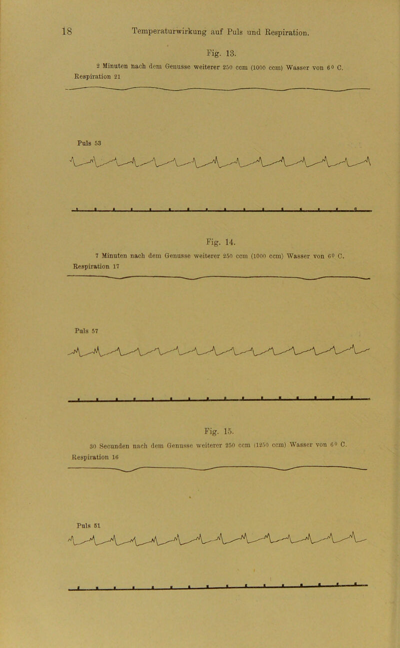 Fig. 13. 2 Minuten nach dem Genüsse weiterer 250 ccm (looo ccm) Wasser von 6<> C. Respiration 21 Puls 53 Fig. 14. 7 Minuten nach dem Genüsse weiterer 250 ccm (lono ccm) Wasser von 60 C. Respiration 17 Puls 57 ■ ■ » ■ ■ « ■ » « • 1 ■ ■ 1 . ■ ..A Fig. 15. 30 Secunden nach dem Genu.sse weiterer 250 ccm (1250 ccm) Wasser von co C. Respiration 16 Puls 61 « « « I I .. I I . I .il -