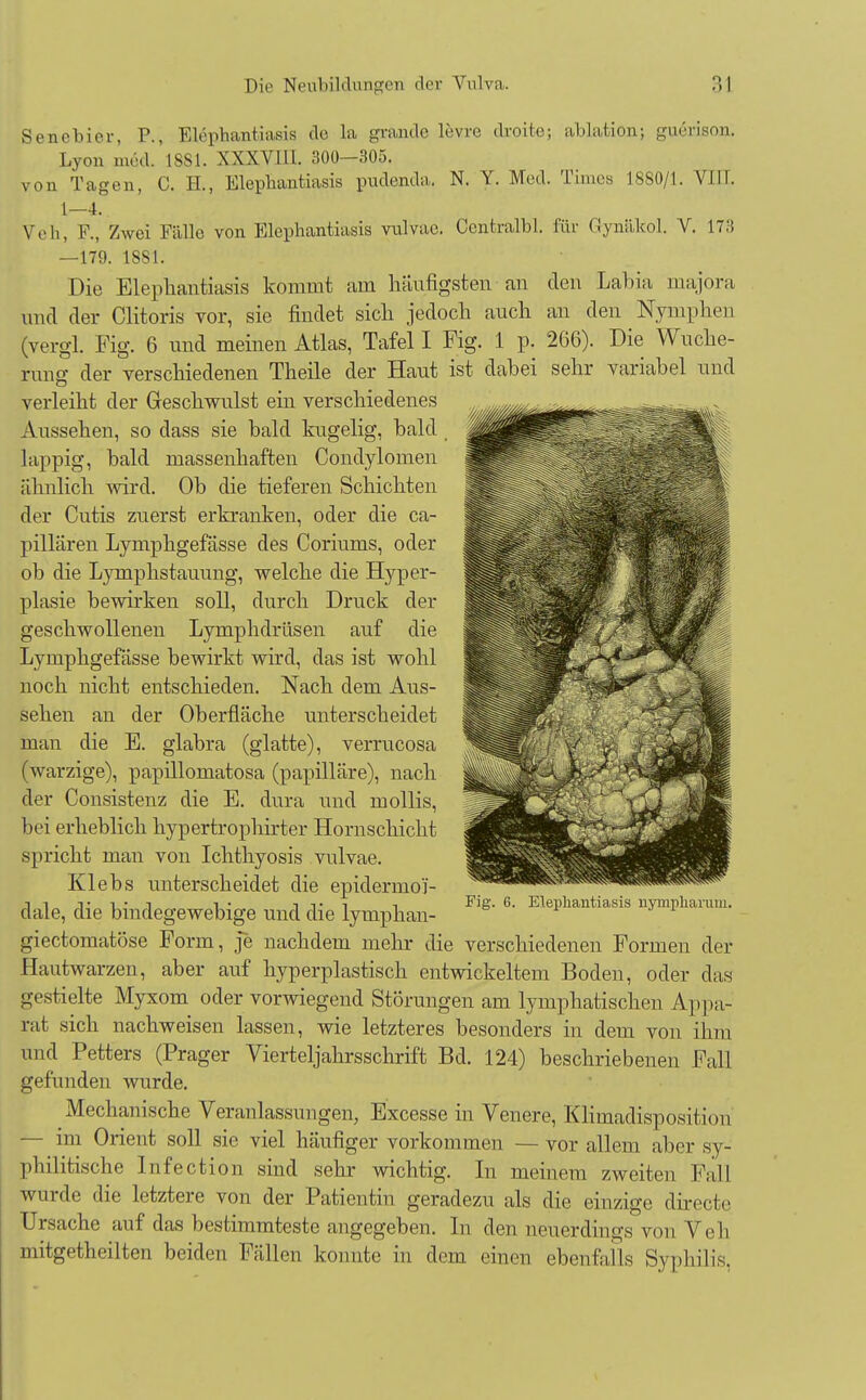 Senebier, P., Elephantiasis de la grande levre droite; ablatio»; gu&ison. Lyon med. 1881. XXXVIIL. 300—305. von Tagen, C. IL, Elephantiasis pudenda. N. Y. Med. Times 1880/1. VIII. 1—4. Veh, F., Zwei Fälle von Elephantiasis vulvae. Centralbl. für Gynäkol. V. 173 —179. 1881. Die Elephantiasis kommt am häufigsten an den Labia majora und der Clitoris vor, sie findet sich jedoch auch an den Nymphen (vergl. Fig. 6 und meinen Atlas, Tafel I Fig. 1 p. 266). Die Wuche- rung der verschiedenen Theile der Haut ist dabei sehr variabel und verleiht der Geschwulst ein verschiedenes Aussehen, so dass sie bald kugelig, bald lappig, bald massenhaften Condylomen ähnlich wird. Ob die tieferen Schichten der Cutis zuerst erkranken, oder die ca- pillären Lymphgefässe des Coriums, oder ob die Lymphstauung, welche die Hyper- plasie bewirken soll, durch Druck der geschwollenen Lymphdrüsen auf die Lymphgefässe bewirkt wird, das ist wohl noch nicht entschieden. Nach dem Aus- sehen an der Oberfläche unterscheidet man die E. glabra (glatte), verrucosa (warzige), papillomatosa (papilläre), nach der Consistenz die E. dura und mollis, bei erheblich hypertrophirter Hornschicht spricht man von Ichthyosis vulvae. Klebs unterscheidet die epidermo'i- dale, die bindegewebige und die lymphan- giectomatöse Form, je nachdem mehr die verschiedenen Formen der Hautwarzen, aber auf hyperplastisch entwickeltem Boden, oder das gestielte Myxom oder vorwiegend Störungen am lymphatischen Appa- rat sich nachweisen lassen, wie letzteres besonders in dem von ihm und Petters (Prager Vierteljahrsschrift Bd. 124) beschriebenen Fall gefunden wurde. Mechanische Veranlassungen, Excesse in Venere, Klimadisposition — im Orient soll sie viel häufiger vorkommen — vor allem aber sy- philitische Infection sind sehr wichtig. In meinem zweiten Fall wurde die letztere von der Patientin geradezu als die einzige directe Ursache auf das bestimmteste angegeben. In den neuerdings von Veh mitgetheilten beiden Fällen konnte in dem einen ebenfalls Syphilis, Fig. 6. Elephantiasis nympharum.