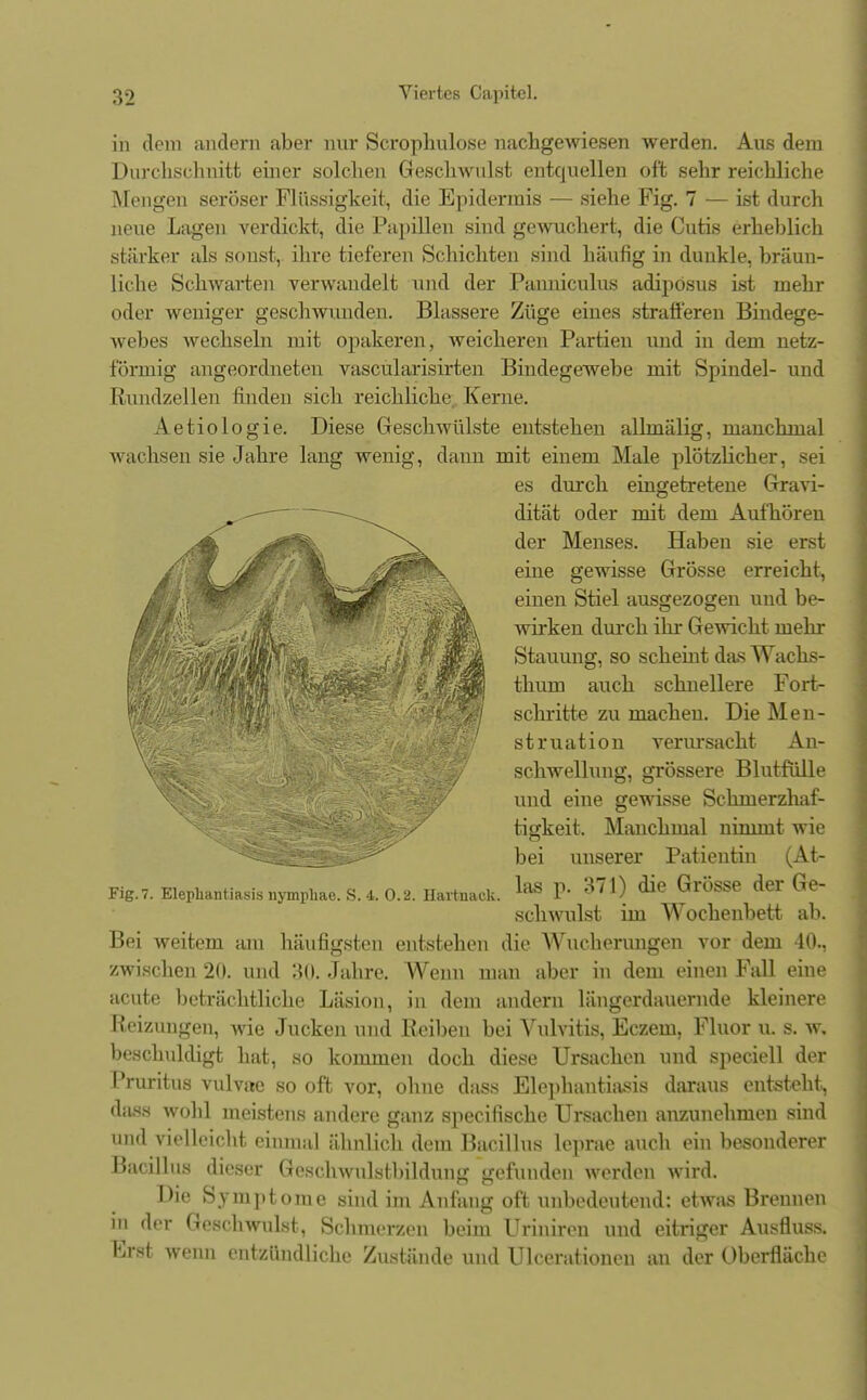 in dem andern aber nur Scrophulose nachgewiesen werden. Aus dem Durchschnitt einer solchen Geschwulst entquellen oft sehr reichliche Mengen seröser Flüssigkeit, die Epidermis — siehe Fig. 7 — ist durch neue Lagen verdickt, die Papillen sind gewuchert, die Cutis erheblich stärker als sonst, ihre tieferen Schichten sind häufig in dunkle, bräun- liche Schwarten verwandelt und der Panniculus adipösus ist mehr oder weniger geschwunden. Blassere Züge eines strafferen Bindege- webes wechseln mit opakeren, weicheren Partien und in dem netz- förmig angeordneten vascularisirten Bindegewebe mit Spindel- und Rundzellen finden sich reichliche. Kerne. Aetiologie. Diese Geschwülste entstehen allmälig, manchmal wachsen sie Jahre lang wenig, dann mit einem Male plötzlicher, sei es durch eingetretene Gravi- dität oder mit dem Aufhören der Menses. Haben sie erst eine gewisse Grösse erreicht, einen Stiel ausgezogen und be- wirken durch ihr Gewicht mehr Stauung, so scheint das Wachs- thum auch schnellere Fort- schritte zu machen. Die Men- struation verursacht An- schwellung, grössere Blutfülle und eine gewisse Schmerzhaf- ^^^^^äBP^ tigkeit. Manchmal nimmt wie i^fgäji^^ bei unserer Patientin (At- Fiß.7. Elephantiasis nymphae. S. 4. 0.2. Hartnack. laS P* 371) ^ GrÖSSe der Ge_ schwulst im Wochenbett ab. Bei weitem am häufigsten entstehen die Wucherungen vor dem 40., zwischen 20. und 30. Jahre. Wenn man aber in dem einen Fall eine acute beträchtliche Läsion, in dem andern längerdauernde kleinere Reizungen, wie Jucken und Reiben bei Vulvitis, Eczem, Fluor u. s. w, beschuldigt hat, so kommen doch diese Ursachen und speciell der Pruritus vulvae so oft vor, ohne dass Elephantiasis daraus entsteht, dass wohl meistens andere ganz specifische Ursachen anzunehmen sind und vielleicht einmal ähnlich dein Bacillus leprae auch ein besonderer Bacillus dieser Geschwulstbildung gefunden werden wird. Die Symptome sind im Anfang oft unbedeutend: etwas Brennen in der Geschwulst, Schmerzen beim Uriniren und eitriger Ausfluss. Erst wenn entzündliche Zustände und Ulcerationen an der Oberfläche