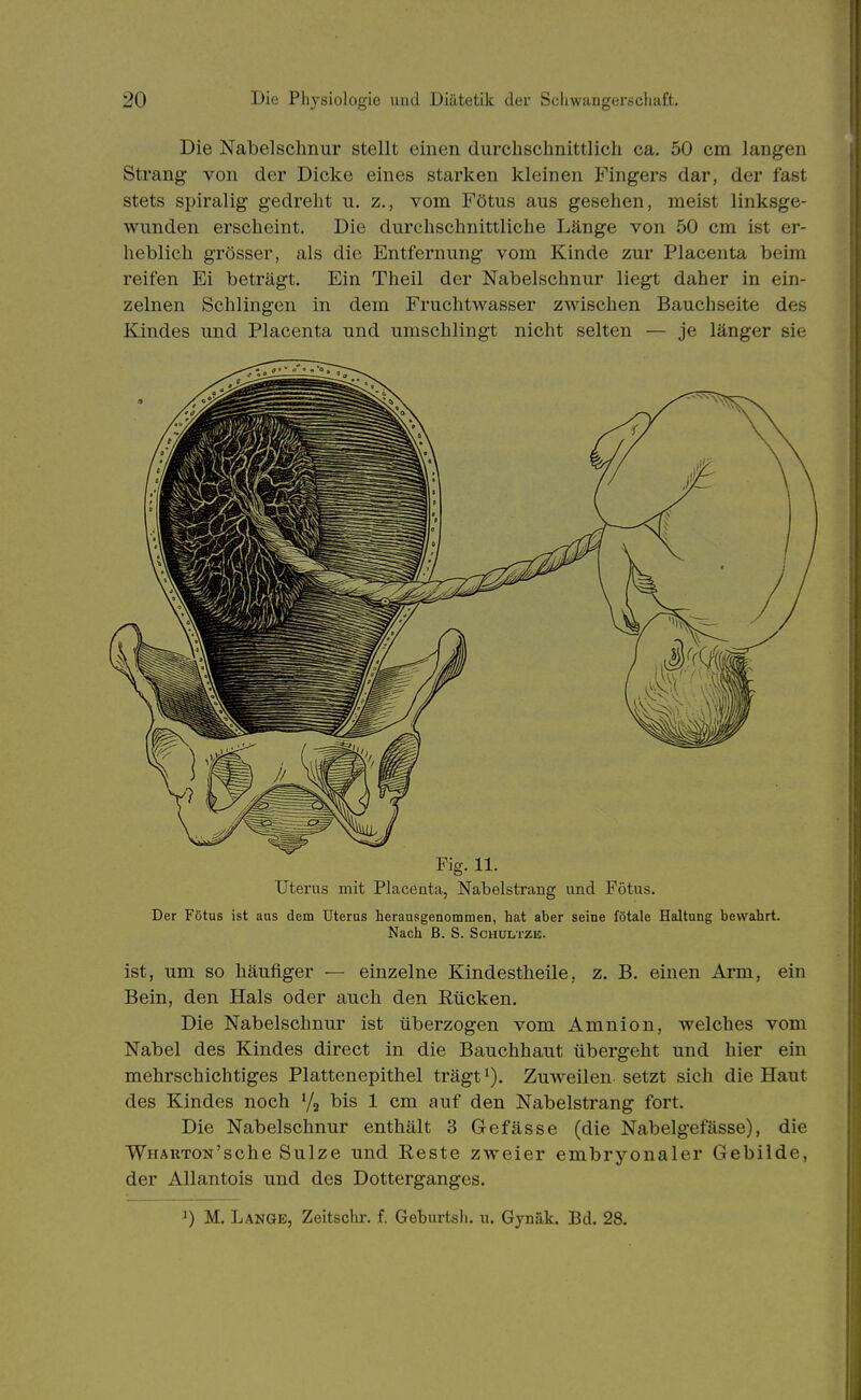 Die Nabelschnur stellt einen durchschnittlich ca. 50 cm langen Strang von der Dicke eines starken kleinen Fingers dar, der fast stets spiralig gedreht u, z., vom Fötus aus gesehen, meist linksge- wunden erscheint. Die durchschnittliche Länge von 50 cm ist er- heblich grösser, als die Entfernung vom Kinde zur Placenta beim reifen Ei beträgt. Ein Theil der Nabelschnur liegt daher in ein- zelnen Schlingen in dem Fruchtwasser zwischen Bauchseite des Kindes und Placenta und umschlingt nicht selten — je länger sie Fig. 11. Uterus mit Placenta, Nabelstrang und Fötus. Der Fötus ist aus dem Uterus herausgenommen, hat aber seine fötale Haltung bewahrt. Nach B. S. ScHULTZE. ist, um so häufiger — einzelne Kindestheile, z. B. einen Arm, ein Bein, den Hals oder auch den Eücken. Die Nabelschnur ist überzogen vom Amnion, welches vom Nabel des Kindes direct in die Bauchhaut übergeht und hier ein mehrschichtiges Plattenepithel trägt Zuweilen setzt sich die Haut des Kindes noch '/g l^is 1 cm auf den Nabelstrang fort. Die Nabelschnur enthält 3 Gefässe (die Nabelgefässe), die WHARTON'sche Sülze und Reste zweier embryonaler Gebilde, der AUantois und des Dotterganges.