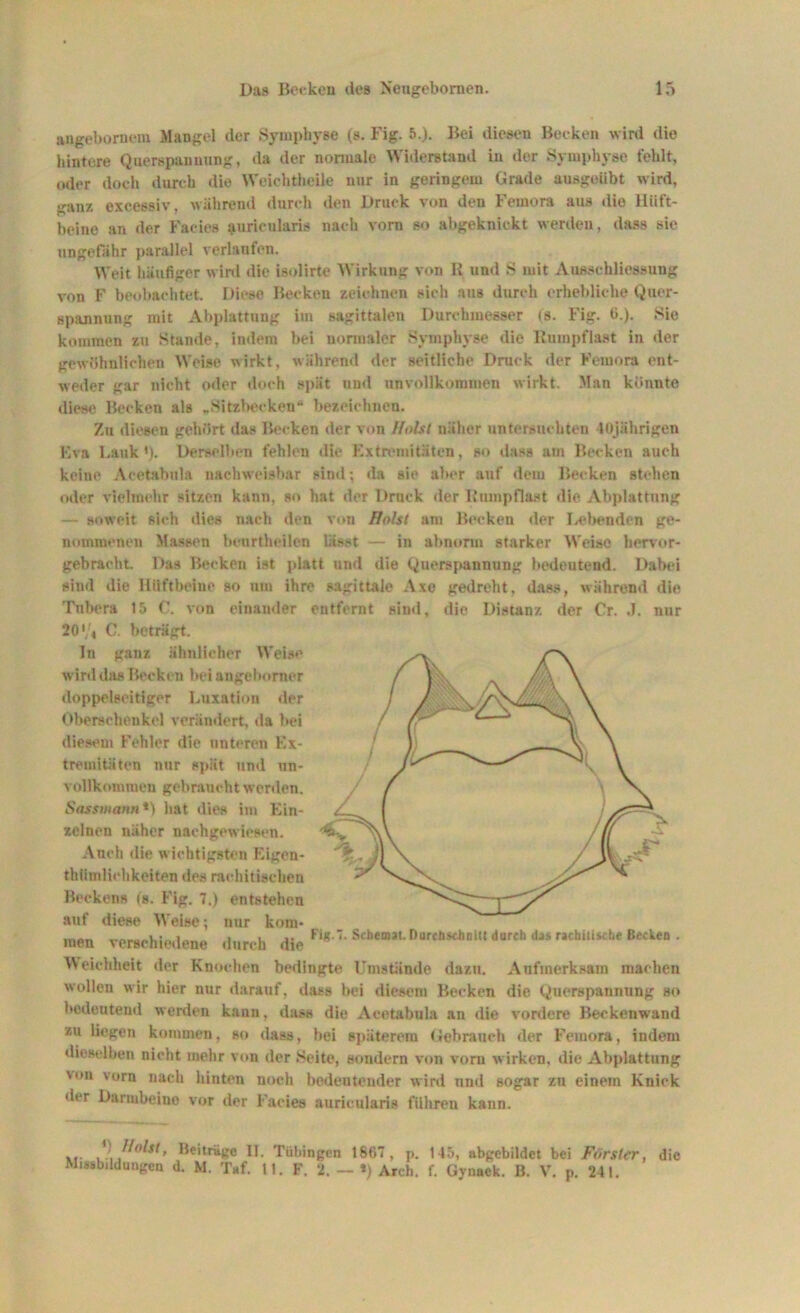 angebornem Mangel der Symphyse (s. Fig. 5.)- Bei diesen Becken wird die hintere Querepannung, da der normale Widerstand in der Symphyse fehlt, oder doch durch die Weichtheile nur in geringem Grade ausgeiibt wird, ganz excessiv, während durch den Druck von den Feinora aus die Hüft- beine an der Facies aurieularis nach vorn so abgeknickt werden, dass sie ungefähr parallel verlaufen. Weit häufiger wird die isolirte Wirkung von R und S mit Ausschliessung von F beobachtet. Diese Becken zeichnen sich aus durch erhebliche Quer- spannung mit Abplattung im sagittalen Durchmesser (s. Fig. 6.). Sie kommen zu Stande, indem bei normaler Symphyse die Rumpflast in der gewöhnlichen Weise wirkt, während der seitliche Druck der Feinora ent- weder gar nicht oder doch spät und unvollkommen wirkt. Man könnte diese Becken als „Sitzbecken“ bezeichnen. Zu diesen gehört das Becken der von Holst näher untersuchten 40jährigen Eva Lank'). Derselben fehlen die Extremitäten, so dass am Becken auch keine Acetabula nachweisbar sind; da sie aber auf dem Becken stellen oder vielmehr sitzen kann, so hat der Druck der Rnmpflast die Abplattung — soweit sich dies nach den von Holst am Becken der Lebenden ge- nommenen Massen beurtheilen lässt — in abnorm starker Weise liervor- gebraeht. Das Becken ist platt und die Querspannung bedeutend. Dabei sind die Hüftbeine so um ihre sagittale Axe gedreht, dass, während die Tnbera 15 C. von einander entfernt sind, dio Distanz der Cr. .1. nur 20 '/4 C. beträgt. ln ganz ähnlicher Weise wird das Becken bei angehonter doppelseitiger Luxation der Oberschenkel verändert, da bei diesem Fehler die unteren Ex- tremitäten nur spät und un- vollkommen gebraucht werden. Sasswann*) hat dies im Ein- zelnen näher nachgewiesen. Anch die wichtigsten Eigen- thiimlichkeiten des rachitischen Beckens (s. Fig. 7.) entstehen auf diese Weise; nur kom- men verschiedene durch die Schema«. Durchschau durch das mhiiüthe Backe» . Weichheit der Knochen bedingte Umstände dazu. Aufmerksam machen wollen wir hier nur darauf, dass bei diesem Becken die Querspannung so bedeutend werden kann, dass die Acetabula an die vordere Beckenwand zu liegen kommen, so dass, bei späterem Gebrauch der Feiuora, indem dieselben nicht mehr von der Beite, sondern von vorn wirken, die Abplattung \on vorn nach hinten noch bedeutender wird und sogar zn einem Knick der Darmbeine vor der Facies aurieularis führen kann. ... /I Beiträge II. Tübingen 1867, p. 145, abgebildet bei Förster, Missbildungen d. M. Taf. 11. F. 2. - *) Arch. f. Gynack. B. V. p. 241. die