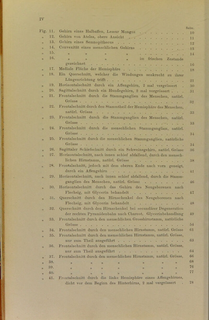12. 13. 14. 15. 16. 17. 18. 19. 20. 21. 22. 23. 24. 25. 26. 27. 28. 29. 30. 31. 32. 33. 34. 35. 36. 37. 38. 39. 40. 41. Seite. Gehirn eines Halbaffen, Lemur Mongoz jq Gehirn von Ateles, obere Ansicht 44 Gehirn eines Semnopithecus 42 Convexität eines menschlichen Gehirns 13 » >1 >* » 14 nun n im frischen Zustande gezeichnet Iß Mediale Fläche der Hemisphäre Ein Querschnitt, welcher die Windungen senkrecht zu ihrer Längenrichtung trifft 21 Horizontalschnitt durch eiu Affengehirn, 2 mal vergrössert . 30 Sagittalschnitt durch ein Hundegehirn, 2 mal vergrössert ... 31 Frontabschnitt durch die Stammganglien des Menschen, natürl. Grösse Frontalschnitt durch den Stammtheil der Hemisphäre des Menschen, natürl. Grösse 33 Frontalschnitt durch die Stammganglien des Menschen, natürl. Grösse 33 Frontalschnitt durch die menschlichen Stammganglien, natürl. Grösse 34 Frontalschnitt durch die menschlichen Stammganglien, natürliche Grösse 34 Sagittaler Schiefschnitt durch eiu Schweinsgehirn, natürl. Grösse 36 Horizontalschnitt, nach innen schief abfallend, durch den mensch- lichen Hirnstamm, natürl. Grösse 38 Frontalschnitt, jedoch mit dem oberen Ende nach vorn geneigt, durch ein Affengehirn 41 Horizontalschnitt, nach innen schief abfallend, durch die Stamm- ganglien des Menschen, natürl. Grösse 46 Horizontalschnitt durch das Gehirn des Neugeborenen nach Flechsig, mit Glycerin behandelt 47 Querschnitt durch den Hirnschenkel des Neugeborenen nach Flechsig, mit Glycerin behandelt 48 Querschnitt durch den Hirnschenkel bei secundärer Degeneration der rechten Pyramidenbahn nach Charcot. Glycerinbehandlung 49 Frontalschnitt durch den menschlichen Grosshirnstamm, natürliche Grösse 54 Frontalschnitt durch den menschlichen Hirnstamm, natürl. Grösse 61 Frontabschnitt durch den menschlichen Hirnstamm, natürl. Grösse, nur zum Theil ausgeführt 63 Frontalschnitt durch den menschlichen Hirnstamm, natürl. Grösse, nur zum Theil ausgeführt 64 Frontalschnitt durch den menschlichen Himstamm, natürl. Grösse, 66 » n n n n » » 76 » !! )) )! n II » 77 n n v r> » n n Frontabschnitt durch die linke Hemisphäre eines Affengehirnes, dicht vor dem Beginn des Hinterhirns, 2 mal vergrössert . 78