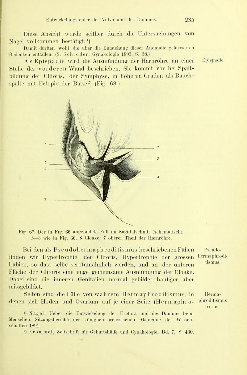 Diese Ansicht wurde seither durch die Untersuchungen von Nagel vollkommen bestätigt.') Damit dürften wohl die über die Entstehung dieser Anomahe geäusserten Bedenken entfallen. (S. Schröder, Gynäkologie 1893, S. 38.) Als Epispadie wird die Ausmündung der Harnröhre an einer Stelle der vorderen Wand beschrieben. Sie kommt vor bei Spalt- bildung der Clitoris, der Symphyse, in höheren Graden als Bauch- spalte mit Ectopie der Blase-) (Fig. 68.) Epispadie. Fig. 67. Der in Fig. 66 abgebildete Fall im Sagittalschnitt (schematisch). 1—5 wie in Fig. 66, 6 Cloake, 7 oberer Theil der Harnröhre. Bei den als P s e u d oh e r m aph r o di t i s mus beschriebenen Fällen Pseudo- fmden wir Hypertrophie der Clitoris. Hypertrophie der grossen hermaphrodi- Labien, so dass selbe scrotumähnlich werden, und an der unteren tismus. Fläche der Clitoris eine enge gemeinsame Ausmündung der Cloake. Dabei sind die inneren Genitalien normal gebildet, häufiger aber missgebildet. Selten sind die Fälle von wahrem Hermaphroditismus, in Herma- denen sich Hoden und Ovarium auf je einer Seite (Hermaphro- phroditismus verus. ') Nagel, Ueber die Entwickelung der Uretln-a und des Dammes beim Menschen. Sitzungsberichte der königlich preussisclien Akademie der Wissen- schaften 1891. 2) Frommel, Zeitschrift für Geburtshülfe und Gynäkologie, Bd. 7, S. 430.