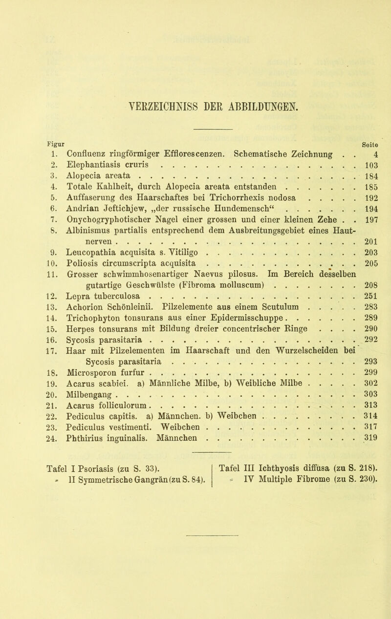 VERZEICHNISS DER ABBILDUNGEN. Figur Seite 1. Confluenz ringförmiger Efflorescenzen. Schematische Zeichnung . . 4 2. Elephantiasis cruris 103 3. Alopecia areata 184 4. Totale Kahlheit, durch Alopecia areata entstanden 185 5. Auffaserung des Haarschaftes bei Trichorrhexis nodosa 192 6. Andrian Jeftichjew, „der russische Hundemensch“ 194 7. Onychogryphotischer Nagel einer grossen und einer kleinen Zehe . . 197 8. Albinismus partialis entsprechend dem Ausbreitungsgebiet eines Haut- nerven 201 9. Leucopathia acquisita s. Vitiligo 203 10. Poliosis circumscripta acquisita 205 11. Grosser schwimmhosenartiger Naevus pilosus. Im Bereich desselben gutartige Geschwülste (Fibroma molluscum) 208 12. Lepra tuberculosa 251 13. Achorion Schönleinii. Pilzelemente aus einem Scutulum ..... 283 14. Trichophyton tonsurans aus einer Epidermisschuppe 289 15. Herpes tonsurans mit Bildung dreier concentrischer Kinge .... 290 16. Sycosis parasitaria 292 17. Haar mit Pilzelementen im Haarschaft und den Wurzelscheiden bei Sycosis parasitaria 293 18. Microsporon furfur 299 19. Acarus scabiei. a) Männliche Milbe, b) Weibliche Milbe 302 20. Milbengang 303 21. Acarus folliculorum 313 22. Pediculus capitis, a) Männchen, b) Weibchen 314 23. Pediculus vestimenti. Weibchen 317 24. Phthirius inguinalis. Männchen 319 Tafel I Psoriasis (zu S. 33). * II Symmetrische Gangrän (zu S. 84). Tafel III Ichthyosis diffusa (zu S. 218). * IV Multiple Fibrome (zu S. 230).