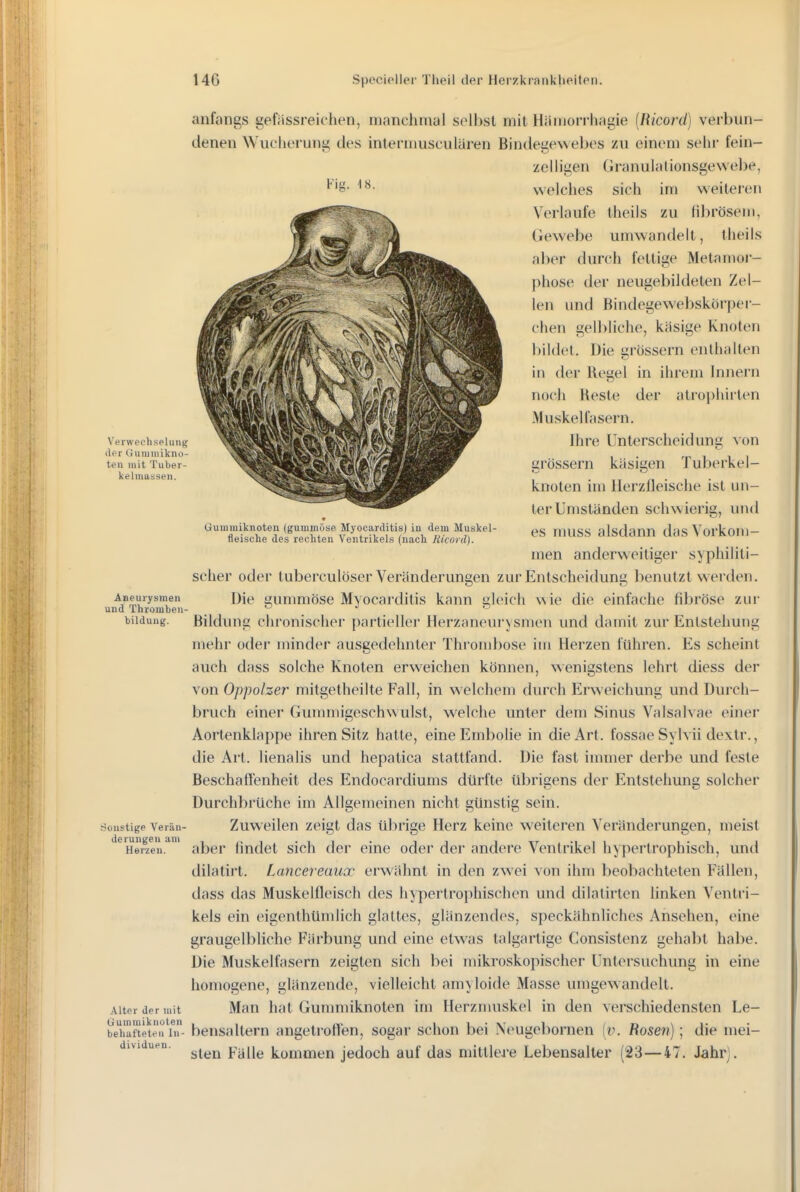 anfangs gefässreichen, manchmal solbst mit Hiiinorrhagie [Ricorä) verbun- denen Wucherung des inleriimscularen Bindesewebes zu einem sehr fein- ze Nigen (iran uIa lionsgewe])e, Fig. -18. Verwechselung der GuiuUlikno- ten uiit Tuber- kelmassen. Die grössern enlhaUen Regel in ihrem Innern Gummiknoten (gummöse Myocartlitis) in dem Muskel- fleisclie des rechten Ventrikels (nach Micord). Aneurysmen und Thromben- bildung. Sonstige Verän- derungen am Herzen. Alter der mit Cjummikuoten behafteten In- dividuen. welches sich im weiteren Verlaufe theils zu librösein, Gewebe umwandelt, theils aber durch fettige Metamor- phose der neugebiideten Zel- len und ßindegewebskörper- clien gelbliche, käsige Knoten bildet, in der noch Reste der atrophiilen Muskellasern. Ihre Unterscheidung von grössern käsigen Tuberkel- knoten im Herzfleische ist un- ter Umständen schwierig, und es muss alsdann das Vorkom- men anderweitiger syphiliti- scher oder tuberculöser Veränderungen zur Entscheidung benutzt werden. Die gummöse Myocarditis kann gknch wie die einfache fibröse zur Bildung chronischer partieller Herzaneurysmen und damit zur Entstehung mehr odei- minder ausgedehnter Thrombose im Herzen führen. Es scheint auch dass solche Knoten erweichen können, wenigstens lehrt diess der von Oppolzer mitgetheilte Fall, in welchem durch Erweichung und Durch- bruch einer Guuuiiigeschwulst, welche unter dem Sinus Valsalvae einer Aortenklappe ihren Sitz hatte, eine Embolie in die Art. fossae Sylvii de\tr., die Art. lienalis und hepatica stattfand. Die fast immer derbe und feste Beschaffenheit des Endocardiums dtirfte übrigens der Entstehung solcher Durchbrüche im Allgemeinen nicht günstig sein. Zuweilen zeigt das übrige Herz keine weiteren Veränderungen, meist aber findet sich der eine oder der andere Ventrikel hj^iertrophisch, und dilatirt. Lancereaux erwähnt in dorn zwei von ihm beobachteten Fällen, dass das Muskelfleisch des hypertrophischen und dilatirten linken Ventri- kels ein eigenthümlich glattes, glänzendes, speckähnliches Ansehen, eine graugelbliche Färbung und eine etwas talgartige Consistenz gehabt habe. Die Muskelfasern zeigten sich bei mikroskopischer Untersuchung in eine homogene, glänzende, vielleicht amyloide Masse umgew andelt. Man hat Gunmiiknoten im Herznuiskel in den verschiedensten Le- bensaltern angetroffen, sogar schon bei Neugebornen [v. Hosen]; die mei- sten Fälle kommen jedoch auf das mittlere Lebensalter {23—47. Jahr].