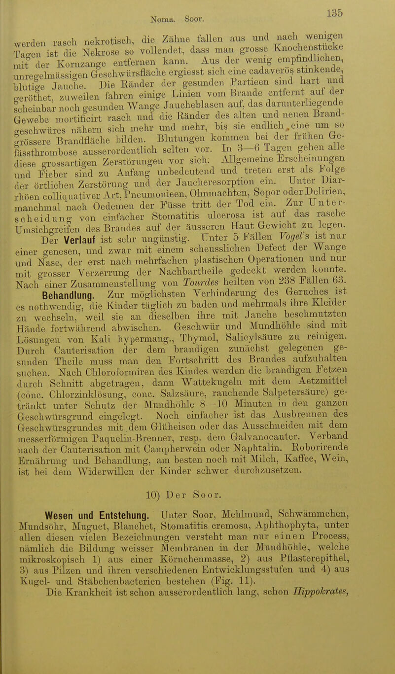 Noma. Soor. werden rasch nekrotisch, die Zähne fallen aus ^^«^^ ^^.^ ff^^ tZZ ist die Nekrose so vollendet, dass man grosse Knochenstiicke mit der Kornzange entfernen kann. Aus der wenig empfindlichen, unregelmässigen Geschwürsfläche ergiesst sich eine cadaveros stmkende blutige Jauche. Die Eänder der gesunden Partieen sind ^art und geröthet, zuweilen fahren einige Limen vom Brande entfernt auf der scheinbar noch gesunden Wange Jaucheblasen auf das darunterliegende Gewebe mortificirt rasch und die Eänder des alten und neuen Brand- geschwüres nähern sich mehr und mehr, bis sie endlich,eine um so grössere Brandfläche bilden. Blutungen kommen bei der frühen Ge- fässthrombose ausserordentlich selten vor. In 3-6 Tagen gehen alle diese grossartigen Zerstörungen vor sich; AUgememe Erschemungen und Äeber sind zu Anfang unbedeutend und treten er&^t als 1 olge der örtlichen Zerstörung und der Jaucheresorption em. Unter Diar- rhöen coUiquativer Ai't, Pneumonieen, Ohnmächten, Sopor oder Delirien, manchmal nach Oedemen der Füsse tritt der Tod em. Zur Unter- scheidung von einfacher Stomatitis ulcerosa ist auf das rasche Umsichgreifen des Brandes auf der äusseren Haut Gewicht zu legen. Der Verlauf ist sehr ungünstig. Unter 5 Fällen Vogel s ist nur einer genesen, und zwar mit einem scheusslichen Defect der Wange und Nase, der erst nach mehrfachen plastischen Operationen und nur mit grosser Verzerrung der Nachbartheüe gedeckt werden konnte. Nach einer Zusammenstellung von Toiirdes heilten von 238 Fallen bö. Behandlung. Zur möglichsten Verhinderung des Geruches ist es nothwendig, die Kinder täglich zu baden und mehrmals ihre Kleider zu wechseln, weil sie an dieselben ihre mit Jauche beschmutzten Hände fortwährend abwischen. Geschwür und Mundhöhle smd mit Lösungen von Kali hypermang., Thymol, Salicylsäure zu reinigen. Durch Cauterisation der dem brandigen zunächst gelegenen ge- sunden Theile muss man den Fortschritt des Brandes aufzuhalten suchen. Nach Chloroformiren des lündes werden die brandigen Fetzen durch Schnitt abgetragen, dann Wattekugeln mit dem Aetzmittel (conc. Chlorzinklösung, conc. Salzsäure, rauchende Salpetersäure) ge- tränkt unter Schutz der Mundhöhle 8—10 Minuten in den ganzen Geschwürsgrund eingelegt. Noch einfacher ist das Ausbrennen des Geschwürsgrundes mit dem Glüheisen oder das Ausschneiden mit dem messerförmigen Paquelin-Brenner, resp. dem Galvanocauter. Verband nach der Cauterisation mit Campherwein oder Naphtalin. Koborirende Ernährung und Behandlung, am besten noch mit Milch, Kaffee, Wein, ist bei dem AViderwillen der Kinder schwer durchzusetzen. 10) Der Soor. Wesen und Entstehung. Unter Soor, Mehlmund, Schwämmchen, Mundsöhr, Muguet, Blanchet, Stomatitis cremosa, Aplithophyta, unter allen diesen vielen Bezeichnungen versteht man nur einen Process, nämlich die Bildung weisser Membranen in der Mundhöhle, welche mikroskopisch 1) aus einer Körnchenmasse, 2) aus Pflasterepithel, 3) aus Pilzen und ihren verschiedenen Entwicklungsstufen und 4) aus Kugel- und Stäbchenbacterien bestehen (Fig. 11). Die Krankheit ist schon ausserordentlich lang, schon Hippokrates,