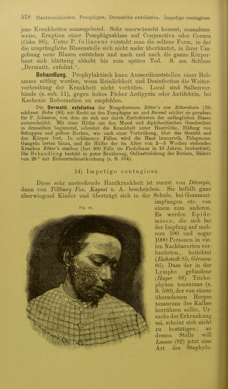 jene Krankheiten maassgebend. Sehr unerwünscht kommt, ausnahms- weise, Eruption einer Pemphigusblase auf Conjunctiva oder Cornea (Cohn 86). Unter P. foliaceus versteht man die seltene Form, in dei- die ursprüngliche Blasenstelle sich nicht mehr überhäutet, in ihrer Um- gebung neue Blasen entstehen und nach und nach die ganze Körper- haut sich blätterig abhebt bis zum späten Tod, S. am Schluss „Dermatit. exfoliat.. Behandlung. Prophylaktisch kann Ausserdienststellen einer Heb- amme nöthig werden, wenn Reinlichkeit und Desinfection die Weiter- verbreitung der Krankheit nicht verhüten. Local sind »Salbenver- bände (s. sub. 11), gegen hohes Fieber Antipyrin oder Antifebrin, bei Kachexie Roborantien zu empfehlen. Die Dermatit. exfoliativa der Neugeborenen Ritter''^ von Rittershain (79) schliesst Bohn (83) mit Recht an den Pemphigus an und Berend erklärt sie geradezu für P. foliaceus, von dem sie sich nur durch Zurücktreten der anfänglichen Blasen unterscheidet. Mit einer Rothe um den Mund und diphtheritischen Geschwüren in demselben beginnend, schreitet die Krankheit unter Hautröthe, Bildung von Schuppen und gelben Borken, wie nach einer Verbrühung, über das Gesicht und den Körper fort. In schlimmen Fällen wird die Haut braunroth, Phlegmone, Gangrän treten hinzu, und die Hälfte der im Alter von 2—5 Wochen stehenden Kranken Ritter^ starben (fast 300 Fälle im Findelhaus in 10 Jahren beobachtet). Die Behandlung besteht in guter Ernährung, Oelbestreichung der Borken, Bädern von 25 mit Eichenrindenabkochung (s. S. 574), 14) Impetigo contagiosa. Diese sehr ansteckende Hautkrankheit ist zuerst von DSvergie^ dann von Tülhury Fox^ Kaposi u. A, beschrieben. Sie befällt ganz überwiegend Kinder und überträgt sich in der Schule, bei Gresammt- impfungen etc. von P'g- einem zum anderen. Es werden Epide- mieen, die sich bei der Impfung auf meh- rere 100 und sogar 1000 Personen in vie- len Nachbarorten ver- breiteten , berichtet (Eichstedt 85, Gerönne 86). Dass der in der Lymphe gefundene (Hager 88) Triclio- pliyton tonsurans (s. S, 580), der von einem übersehenen Herpes tonsurans des Kalbes herrühren sollte, Ur- sache der Erkrankung sei, scheint sich nicht zu bestätigen; an dessen Stelle will Lassar (92) jetzt eine Art des Staphylo- i