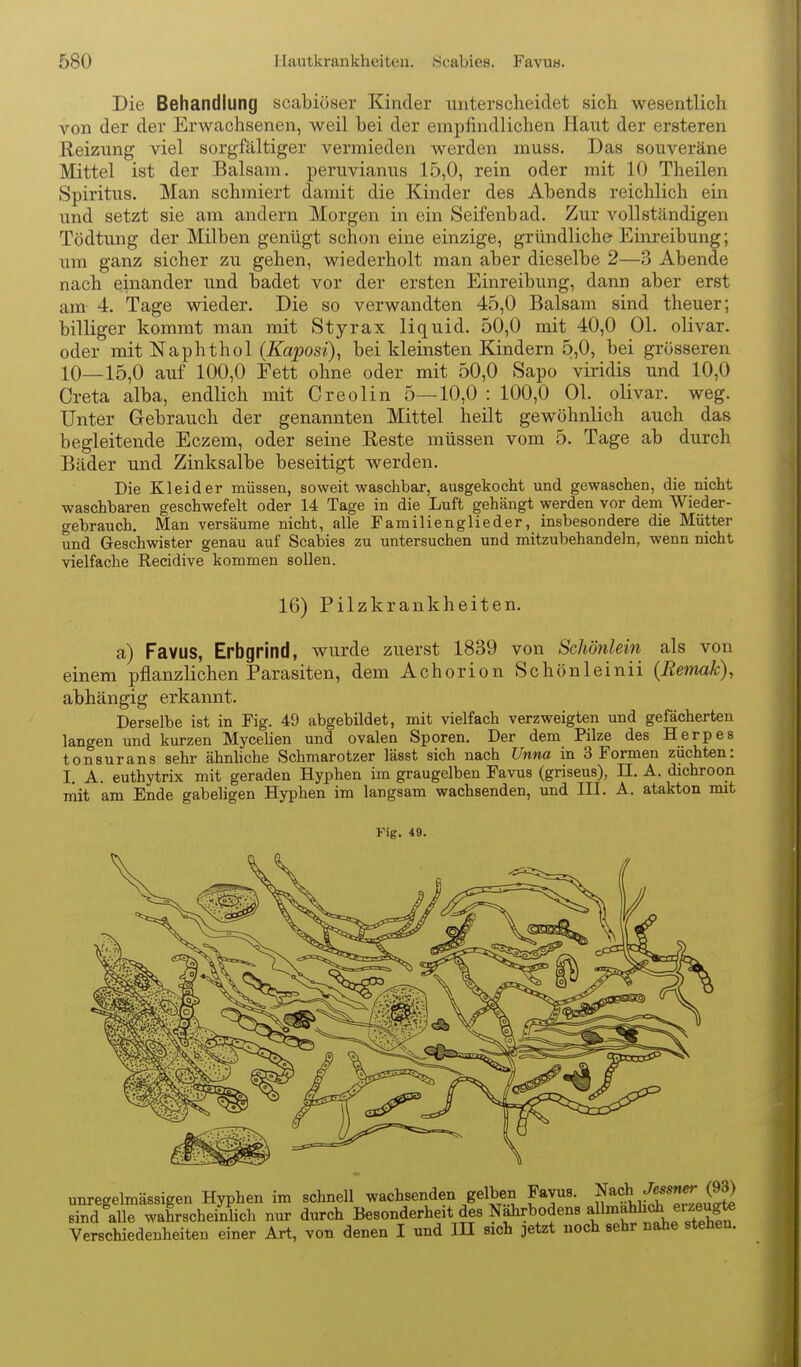 Die Behandlung scabiöaer Kinder unterscheidet sich wesentlich von der der Erwachsenen, weil bei der empfindlichen Haut der ersteren Reizung viel sorgfältiger vermieden werden muss. Das souveräne Mittel ist der Balsam, peruvianus 15,0, rein oder mit 10 Theilen Spiritus. Man schmiert damit die Kinder des Abends reichlich ein und setzt sie am andern Morgen in ein Seifenbad. Zur vollständigen Tödtung der Milben genügt schon eine einzige, gründliche Einreibung; um ganz sicher zu gehen, wiederholt man aber dieselbe 2—3 Abende nach einander und badet vor der ersten Einreibung, dann aber erst am 4. Tage wieder. Die so verwandten 45,0 Balsam sind theuer; billiger kommt man mit Styrax liquid. 50,0 mit 40,0 Ol. olivar. oder mit Naphthol (Kaposi)^ bei kleinsten Kindern 5,0, bei grösseren 10—15,0 auf 100,0 Eett ohne oder mit 50,0 Sapo viridis und 10,0 Greta alba, endlich mit Creolin 5—10,0 : 100,0 Ol. olivar. weg. Unter Gebrauch der genannten Mittel heilt gewöhnlich auch das begleitende Eczem, oder seine Reste müssen vom 5. Tage ab durch Bäder und Zinksalbe beseitigt werden. Die Kleider müssen, soweit waschbar, ausgekocht und gewaschen, die nicht waschbaren geschwefelt oder 14 Tage in die Luft gehängt werden vor dem Wieder- gebrauch. Man versäume nicht, alle Familienglieder, insbesondere die Mütter und Geschwister genau auf Scabies zu untersuchen und mitzubehandeln, wenn nicht vielfache Recidive kommen sollen. 16) Pilzkrankheiten. a) Favus, Erbgrind, wurde zuerst 1839 von Schönlein als von einem pflanzlichen Parasiten, dem Achorion Schönleinii (Remak), abhängig erkannt. Derselbe ist in Fig. 49 abgebildet, mit vielfach verzweigten und gefächerten langen und kurzen Mycelien und ovalen Sporen. Der dem Pilze des Herpes tonsurans sehr ähnliche Schmarotzer lässt sich nach Unna in 3 Formen züchten: I. A. euthytrix mit geraden Hyphen im graugelben Favus (griseus), II. A. dichroon mit am Ende gabeligen Hyphen im langsam wachsenden, und III. A. atakton mit Fig. 49. unregelmässigen Hyphen im schnell wachsenden gelben Favus. f^^f.^ff'^J^^^^ Bind alle wahrscheinlich nur durch Besonderheit des Nährbodens allmahhc^ erz^^^^^ Verschiedenheiten einer Art, von denen I und in sich jetzt noch sehr nahe stehen.