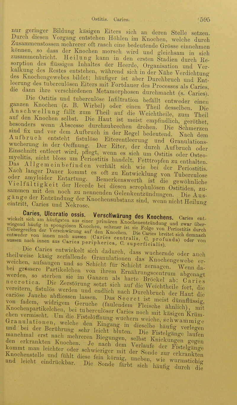 nur geringer Bildung käsigen Eiters sich an deren Stelle setzen. IJurch diesen Vorgang entstehen Höhlen im Knochen, welche durch Zusammenstossen mehrerer oft rasch eine bedeutende Grösse einnehmen können, so dass der Knochen morsch Avird und gleichsam in sich zusammenbricht. Heilung kann in den ersten Stadien durch Re- sorption des flüssigen Inhaltes der Heerde, Organisation und Ver- kalkung des Bestes entstehen, während sich in der Nähe Verdichtune- des Knochengewebes bildet; häufiger ist aber Durchbruch und Ent- leerung des tuberculösen Eiters mit Fortdauer des Processes als Caries die dann ihre verschiedenen Metamorphosen durchmacht (s. Caries).' Die Ostitis und tuberculöse Infiltration befällt entweder einen ganzen Knochen (z. B. Wirbel) oder' einen Theil desselben. Die Anschwellung fäUt zum Theil auf die Weichtheile, zum Theil auf den Knochen selbst. Die Haut ist meist empfindlidi, geröthei besonders wenn Abscesse durchzubrechen drohen. Die Schmerzen smd fix und vor dem Aufbruch in der Regel bedeutend. Nach dem Aufbruch entsteht fistulöse Eiterentleerung und Granulation^ Ztr^? - der OefFnung. Der Eiter, der Lch AufbiS oI^^^ Emschnitt entleert wird, pflegt, wenn es sich um Ostitis oder Osteo SL Ahr ' ^''l' ^^-Periostitis handelt, Eetttropfen zu enthal n. S«.\f ^ '^.''''^'/'''^^ ''^^^^ bei der Periostitis odei ÄM^rT.^r' ? Entwicklung von Tubercul se vTelfäm±^ Bemerkenswerth ist die gewöhnliche aussen nach innen aus Oaries peripherica a supe^nciSlis)^'^^ weichen, aufsaugen und so Schicht für Schicht zenZin^ W ! Knochenpartikelchen, bei tuberculöser Caries nocl mit kWp. \f eben vermischt. Tim diV R^Jofai;^«' , i  ivasigen Krum- Granulationen ^lohe ltpS ^^7- t''^' »l'^ammige manchmal erst nach nfehre n Bitun^e^ .f^tfg«?'' laufen den erkrankten Knochen. Je nS S Y^U f '^^g« g<=gen und leicht eindraokha'^'^^l'ÄÄhSg-Ä