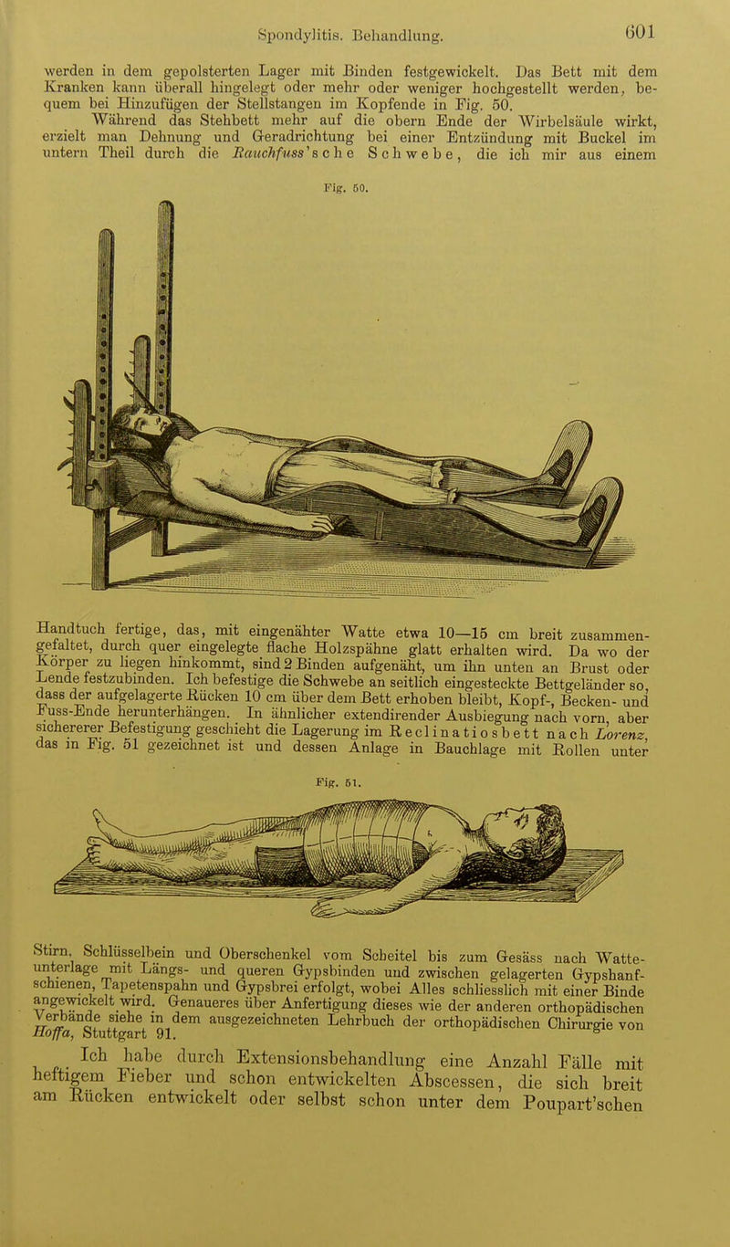 Spondylitis. Behandlung. werden in dem gepolsterten Lager mit Binden festgewickelt. Das Bett mit dem Kranken kann überall hingelegt oder mehr oder weniger hochgestellt werden, be- quem bei Hinzufügen der Stellstangen im Kopfende in Fig. 50. Während das Stehbett mehr auf die obern Ende der Wirbelsäule wirkt, erzielt man Dehnung und Geradrichtung bei einer Entzündung mit Buckel im untern Theil durch die Eauchfuss'b oh e Schwebe, die ich mir aus einem Handtuch fertige, das, mit eingenähter Watte etwa 10—15 cm breit zusammen- gefaltet, durch quer eingelegte flache Holzspähne glatt erhalten wird. Da wo der Korper zu hegen hinkommt, sind 2 Binden aufgenäht, um ihn unten an Brust oder Lende festzubmden. Ich befestige die Schwebe an seitHch eingesteckte Bettgeländer so dass der aufgelagerte üücken 10 cm über dem Bett erhoben bleibt, Kopf-, Becken- und Fuss-Ende herunterhängen. In ähnlicher extendirender Ausbiegung nach vom aber sichererer Befestigung geschieht die Lagerung imReclinatiosbett nach Lorenz das m Flg. 51 gezeichnet ist und dessen Anlage in Bauchlage mit Eollen unter Fig. 61. Stirn Schlüsselbein und Oberschenkel vom Scheitel bis zum Gesäss nach Watte- unterlage mit Längs- und queren Gypsbinden und zwischen gelagerten Gypshanf- schienen Tapetenspahn und Gypsbrei erfolgt, wobei Alles schliesslich mit einer Binde angewickelt wd; Genaueres über Anfertigung dieses wie der anderen orthopädischen flb^a Stuttgart'91 ausgezeichneten Lehrbuch der orthopädischen Chirurgie von Ich habe durch Extensionsbehandliing eine Anzahl Fälle mit heftigem Fieber und schon entwickelten Abscessen, die sich breit am Eücken entwickelt oder selbst schon unter dem Poupart'schen