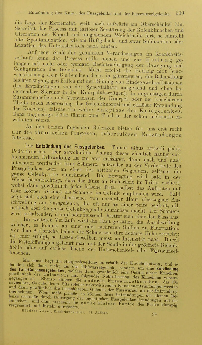 die Lage der Extremität, weit nach aufwärts am Oberschenkel Inn. Schreitet der Process mit cariöser Zerstörung der Gelenkknochen und Ulceration der Kapsel und umgebenden Weiohtheile fort, so entsteht öfter Spontanluxation, wie am Hüftgelenk, und zwar Subluxation oder Luxation des Untersclienkels nach hinten. Auf jeder Stufe der genannten Veränderungen im Krankheits- verlaufe kann der Process stille stehen und zur Heilung ge- langen mit mehr oder weniger Beeinträchtigung der Bewegung^ und Conhguration des Gelenkes. Meist erfolgt die Heilung mit Ver- w_a c h s u n g der G e 1 e n k e n d e n: in günstigeren, de? Behandlung leichter zugängigen Fällen mit der Bildung von Bindegewebsadhäsionen (bei Entzündungen von der Synovialhaut ausgehend und ohne be- deutendere Störung in den Knorpelüberzügen); in ungünstigen durch Zusammenheilen und Verwachsen der Knorpel oder der knöchernen 1 heile (nach Abstossung der Gelenkknorpel und cariöser Entzündung der Knochen): falsche und wahre Ankylose des Kniegelenkes Ganz ungünstige Fälle führen zum T o d in der schon mehrmals er- wähnten Weise. An den beiden folgenden Gelenken bieten für uns erst recht nur die chronischen fungösen, tuberculösen Entzündungen Interesse. ' Die Entzündung des Fussgelenkes. Tumor albus articuli pedis. Podarthrocace. Der gewöhnliche Anfang dieser ziemlich häufig vor- kommenden Erkrankung ist ein erst mässiger, dann nach und nach intensiver werdender fixer Schmerz, entweder an der Vorderseite des Fussgelenkes oder an einer der seitlichen Gegenden, seltener die ganze Gelenkpartie einnehmend. Die Bewegung wird bald in der Weise beeinträchtigt, dass der Fuss an Sicherheit im Tritte verliert Jll'V gewöhnlich jeder falsche Tritt, selbst das Auftreten auf feste Korper (Sterne) als Schmerz im Gelenk empfunden wird. Bald zeigt sich auch eme elastische, von normaler Haut überzogene An- schwellung am Fussgelenke, die oft nur an einer Seite beginnt, äll- wta f if if V Gelenkgegend voluminöser macht. De? Schmerz wild anhaltender, dumpf oder reissend, breitet sich über den Fuss aus. weiobP^ T^i'la^fe wird die Haut geröthet, die AnschweUung Vn. ' f '^f mehreren Stellen zu Fluctuation l£\t^t^^T^ i'^' Schmerzen ihi-e höchste Höhe erreicht: itSii- i ^ ' lf«e^ dieselben meist an Litensität nach. Durch hihi! idef T/' geöffnete Gelenk- knochen Unterschenkel- oder Fij^swurzel- handei?':STann1-chr uÄ'^Sir^ T^f'^f' der Knöchelspitzen, und es fegangen ist Ebenr IL «^folgender Nekrotisirung des Knochens voraus- ^^^^^^^^^^^^ vergrössert, mit Fisteln durchsetzt. ^^^^^ Fartie des Fusses klumpig Biedert-Vogel, Kinderkrankheiten. 11. Auflage. gg