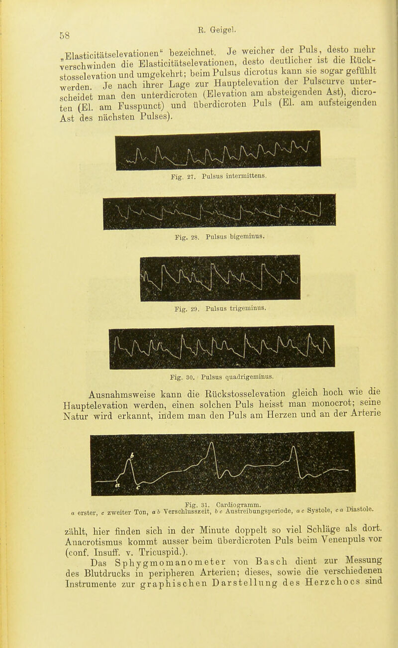 Blasticitätselevationen bezeichnet. Je weicher der Puls desto mehr verschwinden die Blasticitätselevationen, desto deutlicher ist die Rück- stosselevation und umgekehrt; beim Pulsus dicrotus kann sie sogar gefühlt werden Je nach ihrer Lage zur Hauptelevation der Pulscurve unter- scheidet man den unterdicroten (Elevation am absteigenden Ast), dicro- ten (El. am Fusspunct) und überdicroten Puls (El. am aufsteigenden Ast des nächsten Pulses). Fig. 27. Pulsus intermittens. Fig. 28. Pulsus Mgeminus. Fig. 29. Pulsus trigeminus. Fig. 30. Pulsus quadrigemiuus. Ausnahmsweise kann die Rückstosselevation gleich hoch wie die Hauptelevation werden, einen solchen Puls heisst man monocrot; seine Natur wird erkannt, indem man den Puls am Herzen und an der Arterie zählt, hier finden sich in der Minute doppelt so viel Schläge als dort. Anacrotismus kommt ausser beim überdicroten Puls beim Venenpuls vor (conf. Insuff. v. Tricuspid.). Das Sphygmomanometer von Bäsch dient zur Messung des Blutdrucks in peripheren Arterien; dieses, sowie die verschiedenen Instrumente zur graphischen Darstellung des Herzchocs sind