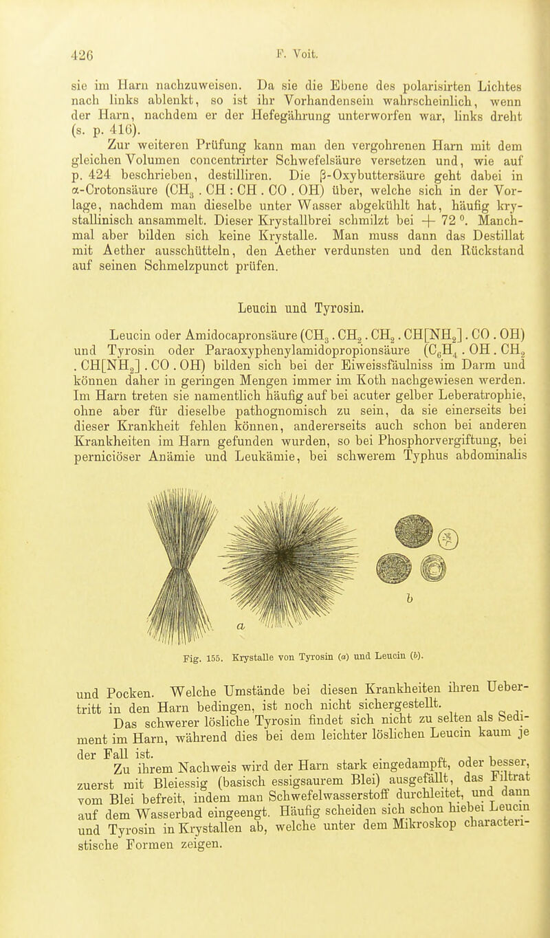sie im Harn nachzuweisen. Da sie die Ebene des polarisirten Lichtes nach links ablenkt, so ist ihr Vorhandensein wahrscheinlich, wenn der Harn, nachdem er der Hefegähi-ung unterworfen war, links dreht (s. p. 41G). Zur weiteren Prüfung kann man den vergohrenen Harn mit dem gleichen Volumen concentrirter Schwefelsäure versetzen und, wie auf p. 424 beschrieben, destilliren. Die ß-Oxybuttersäure geht dabei in a-Crotonsäure (CH,j . CH : CH . CO . OH) über, welche sich in der Vor- lage, nachdem man dieselbe unter Wasser abgekühlt hat, häufig Icry- stallinisch ansammelt. Dieser Krystallbrei schmilzt bei -(- 72 Manch- mal aber bilden sich keine Krystalle. Man muss dann das Destillat mit Aether ausschütteln, den Aether verdunsten und den Rückstand auf seinen Schmelzpunct prüfen. Leucin und Tyrosin. Leucin oder Amidocapronsäure (CHg. CHg. CHg. CH[NH2] . CO . OH) und Tyrosin oder Paraoxyphenylamidopropionsäure (C^H^ . OH . CHg . CH[NH2] . CO . OH) bilden sich bei der Eiweissfäulniss im Darm und können daher in geringen Mengen immer im Koth nachgewiesen werden. Im Harn treten sie namentlich häufig auf bei acuter gelber Leberatrophie, ohne aber für dieselbe pathognomisch zu sein, da sie einerseits bei dieser Krankheit fehlen können, andererseits auch schon bei anderen Krankheiten im Harn gefunden wurden, so bei Phosphorvergiftung, bei perniciöser Anämie und Leukämie, bei schwerem Typhus abdominalis Fig. 155. Krystalle von Tyi-osin (o) und Leuoiu (i). und Pocken. Welche Umstände bei diesen Krankheiten ihren Ueber- tritt in den Harn bedingen, ist noch nicht sichergestellt. , „ Das schwerer lösliche Tyrosin findet sich nicht zu selten als bedi- ment im Harn, während dies bei dem leichter löslichen Leucm kaum je der Fall ist. . , p, j u Zu ihrem Nachweis wird der Harn stark eingedampft, oder besser, zuerst mit Bleiessig (basisch essigsaurem Blei) ausgefällt das J^iitrat vom Blei befreit, indem man Schwefelwasserstoff durchleitet, und dann auf dem Wasserbad eingeengt. Häufig scheiden sich schon hiebei Leucm und Tyrosin inKrystallen ab, welche unter dem Mikroskop characten- stische Formen zeigen.