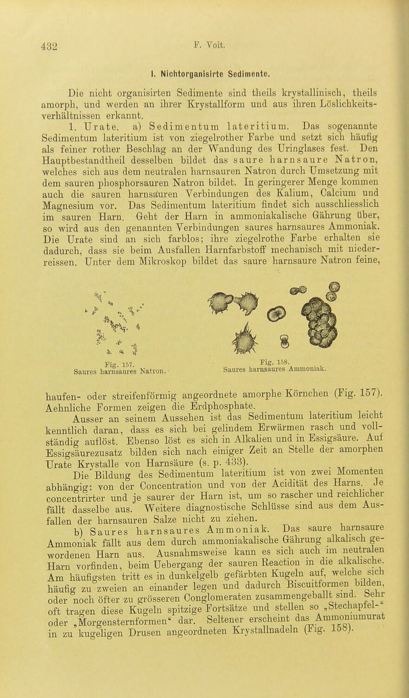 I. Nichtorganisirte Sedimente. Die nicht organisirten Sedimente sind theils krystallinisch, theils amorph, und werden an ihrer Krystallform und aus ihren Löshchkeits- verhältnissen erkannt. 1. Urate. a) Sedimentum lateritium. Das sogenannte Sedimentum hiteritium ist von ziegelrother Farbe und setzt sich häufig als feiner rother Beschlag an der Wandung des Uringlases fest. Den Hauptbestandtheil desselben bildet das saure harn saure Natron, welches sich aus dem neutralen harnsauren Natron durch Umsetzung mit dem sauren phosphorsauren Natron bildet. In geringerer Menge kommen auch die sauren harnsäuren Verbindungen des Kalium, Calcium und Magnesium vor. Das Sedimentum lateritium findet sich ausschliesshch im sauren Harn. Geht der Harn in ammoniakalische Gährung über, so wird aus den genannten Verbindungen saures harnsaures Ammoniak. Die Urate sind an sich farblos; ihre ziegelrothe Farbe erhalten sie dadurch, dass sie beim Ausfallen Harnfarbstofi' mechanisch mit nieder- reissen. Unter dem Mikroskop bildet das saure harnsaure Natron feine, Fig. 157. J^iB- io»- Sam-es liarnsaures Natron. ■ Saures harnsaui'es Ammoniak. häufen- oder streifenförmig angeordnete amorphe Körnchen (Fig. 157). Aehnliche Formen zeigen die Erdphosphate. Ausser an seinem Aussehen ist das Sedimentum lateritium leicht kenntlich daran, dass es sich bei gelindem Erwärmen rasch und voll- ständig auflöst. Ebenso löst es sich in Alkahen und in Essigsäure. Auf Essigsäurezusatz bilden sich nach einiger Zeit an Stelle der amorphen Urate Krystalle von Harnsäure (s. p. 433). Die Bildung des Sedimentum lateritium ist von zwei Momenten abhängi'^: von der Concentration und von der Acidität des Harns. Je concentrirter und je saurer der Harn ist, um so rascher und reichlicher fällt dasselbe aus. V\^eitere diagnostische Schlüsse smd aus dem Aus- fallen der harnsauren Salze nicht zu ziehen. b) Saures harnsaures Ammoniak. Das saure harnsaure Ammoniak fällt aus dem durch ammoniakalische Gährung alkahsch ge- wordenen Harn aus. Ausnahmsweise kann es sich auch nn neutra en Harn vorfinden, beim Uebergang der sauren Reaction m die a kahsche. Am häufigsten tritt es in dunkelgelb gefärbten Kugeln auf, welche sich häufig zu zweien an einander legen und dadurch Biscuitfomen bilden, oder noch öfter zu grösseren Conglomeraten zusammengeballt sind, behr oft tragen diese Kugeln spitzige Fortsätze und steUen so „btechaptel- oder „Morgensternformen dar. Seltener erscheint das Ammomumurat in zu kugeligen Drusen angeordneten Krystallnadeln [big. iööj.