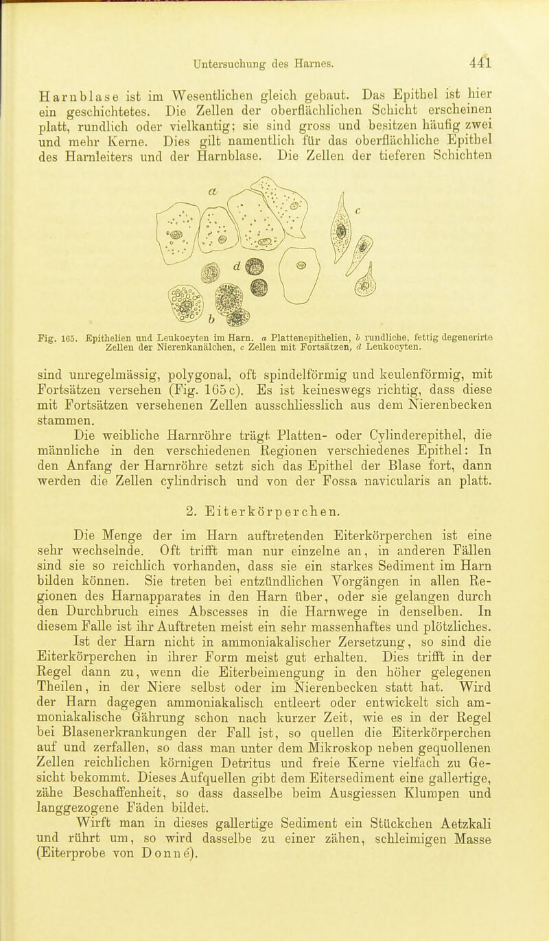 Harnblase ist im Wesentlichen gleich gebaut. Das Epithel ist hier ein geschichtetes. Die Zellen der oberflächlichen Schicht erscheinen platt, rundlich oder vielkantig; sie sind gross und besitzen häufig zwei und mehr Kerne. Dies gilt namentlich für das oberflächliche Epithel des Harnleiters und der Harnblase. Die Zellen der tieferen Schichten Fig. 165. Epitlielien und Leukocyten im Harn, a Plattenepithelien, b nmdliohe, fettig degeneiirte Zellen der Nierenkanälchen, c Zellen mit Foi-tsätzen, d Leukocyten. sind unregelmässig, polygonal, oft spindelförmig und keulenförmig, mit Fortsätzen versehen (Fig. 165 c). Es ist keineswegs richtig, dass diese mit Fortsätzen versehenen Zellen ausschliesslich aus dem Nierenbecken stammen. Die weibliche Harnröhre trägt Platten- oder Cylinderepithel, die männliche in den verschiedenen Regionen verschiedenes Epithel: In den Anfang der Harnröhre setzt sich das Epithel der Blase fort, dann werden die Zellen cylindrisch und von der Fossa navicularis an platt. 2. Eiterkörperchen. Die Menge der im Harn auftretenden Eiterkörperchen ist eine sehr wechselnde. Oft trifft man nur einzelne an, in anderen Fällen sind sie so reichlich vorhanden, dass sie ein starkes Sediment im Harn bilden können. Sie treten bei entzündlichen Vorgängen in allen Re- gionen des Harnapparates in den Harn über, oder sie gelangen durch den Durchbruch eines Abscesses in die Harnwege in denselben. In diesem Falle ist ihr Auftreten meist ein sehr massenhaftes und plötzliches. Ist der Harn nicht in ammoniakalischer Zersetzung, so sind die Eiterkörperchen in ihrer Form meist gut erhalten. Dies trifft in der Regel dann zu, wenn die Eiterbeimengung in den höher gelegenen Theilen, in der Niere selbst oder im Nierenbecken statt hat. Wird der Harn dagegen ammoniakalisch entleert oder entwickelt sich am- moniakalische Gährung schon nach kurzer Zeit, wie es in der Regel bei Blasenerkrankungen der Fall ist, so quellen die Eiterkörperchen auf und zerfallen, so dass man unter dem Mikroskop neben gequollenen Zellen reichlichen körnigen Detritus und freie Kerne vielfach zu Ge- sicht bekommt. Dieses Aufquellen gibt dem Eitersediment eine gallertige, zähe Beschaffenheit, so dass dasselbe beim Ausgiessen Klumpen und langgezogene Fäden bildet. Wirft man in dieses gallertige Sediment ein Stückchen Aetzkali und rührt um, so wird dasselbe zu einer zähen, schleimigen Masse (Eiterprobe von Donne).