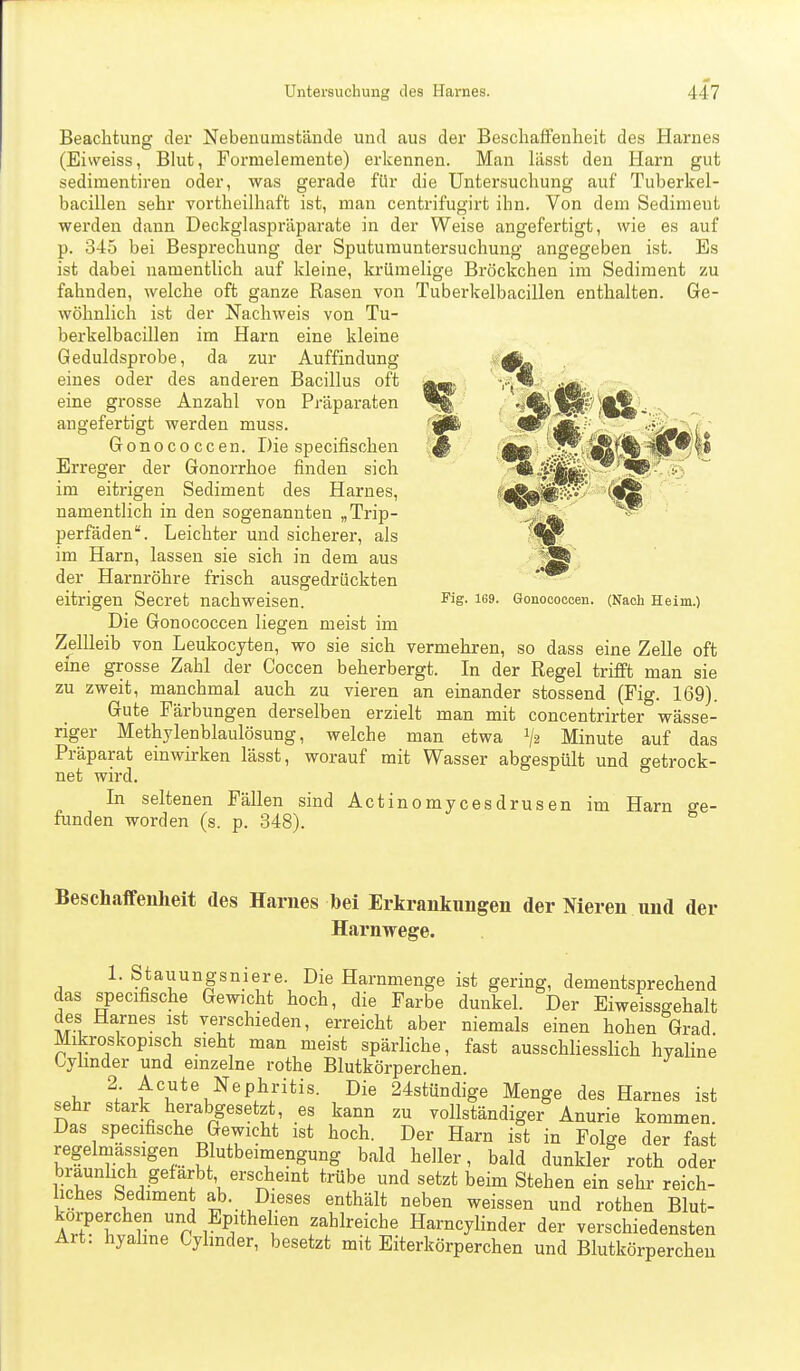 Beachtung der Nebenurastände und aus der Beschaffenheit des Harnes (Eiweiss, Blut, Formelemente) erkennen. Man lässt den Harn gut sedimentiren oder, was gerade für die Untersuchung auf Tuberkel- bacillen sehr vortheilhaf't ist, man centrifugirt ihn. Von dem Sediment werden dann Deckglaspräparate in der Weise angefertigt, wie es auf p. 345 bei Besprechung der Sputumuntersuchung angegeben ist. Es ist dabei namentlich auf kleine, krümelige Bröckchen im Sediment zu fahnden, welche oft ganze Rasen von Tuberkelbacillen enthalten. Ge- wöhnlich ist der Nachweis von Tu- berkelbacillen im Harn eine kleine Geduldsprobe, da zur Auffindung eines oder des anderen Bacillus oft eine grosse Anzahl von Präparaten angefertigt werden muss. Gonococcen. Die specifischen Erreger der Gonorrhoe finden sich im eitrigen Sediment des Harnes, namentlich in den sogenannten „Trip- perfäden. Leichter und sicherer, als im Harn, lassen sie sich in dem aus der Harnröhre frisch ausgedrückten eitrigen Secret nachweisen. Die Gonococcen liegen meist im Zellleib von Leukocyten, wo sie sich vermehren, so dass eine Zelle oft eine grosse Zahl der Coccen beherbergt. In der Regel trifft man sie zu zweit, manchmal auch zu vieren an einander stossend (Fig. 169). Gute Färbungen derselben erzielt man mit concentrirter wässe- riger Methylenblaulösung, welche man etwa Minute auf das Präparat einwirken lässt, worauf mit Wasser abgespült und getrock- net wird. In seltenen Fällen sind Actinomycesdrusen im Harn ge- funden worden (s. p. 348). Fig. 169. Gonococcen. (Nach Heim.) Beschaffenheit des Harnes bei Erkrankungen der Nieren und der Harnwege. 1. Stauungsniere. Die Harnmenge ist gering, dementsprechend das specifische Gewicht hoch, die Farbe dunkel. Der Eiweissgehalt des Harnes ist verschieden, erreicht aber niemals einen hohen Grad Mikroskopisch sieht man meist spärliche, fast ausschliesslich hyaline Oyünder und einzelne rothe Blutkörperchen. 2 Acute Nephritis. Die 24stündige Menge des Harnes ist sehr stark herabgesetzt, es kann zu vollständiger Anurie kommen. Das specifische Gewicht ist hoch. Der Harn ist in Folge der fast regelmassigen Blutbeimengung bald heller, bald dunkler roth oder bräunlich gefärbt erschemt trübe und setzt beim Stehen ein sehr reich- liches Sediment ab. Dieses enthält neben weissen und rothen Blut- körperchen und Epithehen zahlreiche Harncylinder der verschiedensten Art: hyahne Cyhnder, besetzt mit Eiterkörperchen und Blutkörperchen